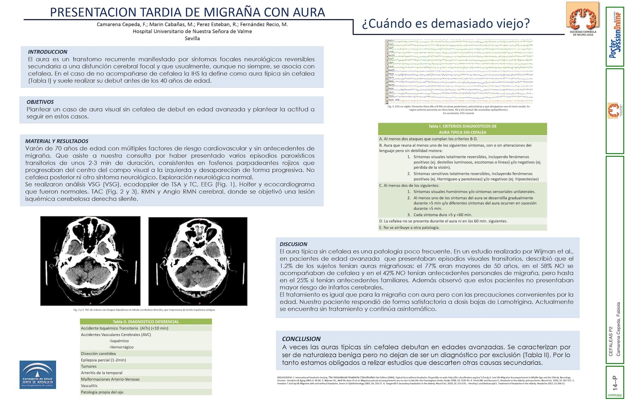 PRESENTACION TARDIA DE MIGRAÑA CON AURA: ¿Cuándo es demasiado viejo?
