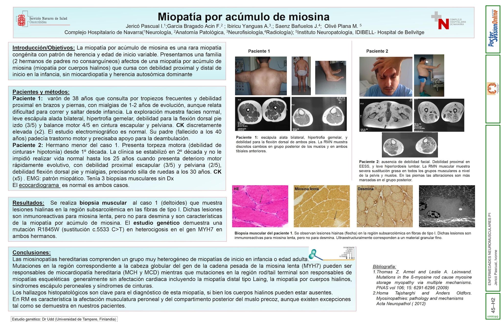 MIOPATÍA POR ACÚMULO DE MIOSINA