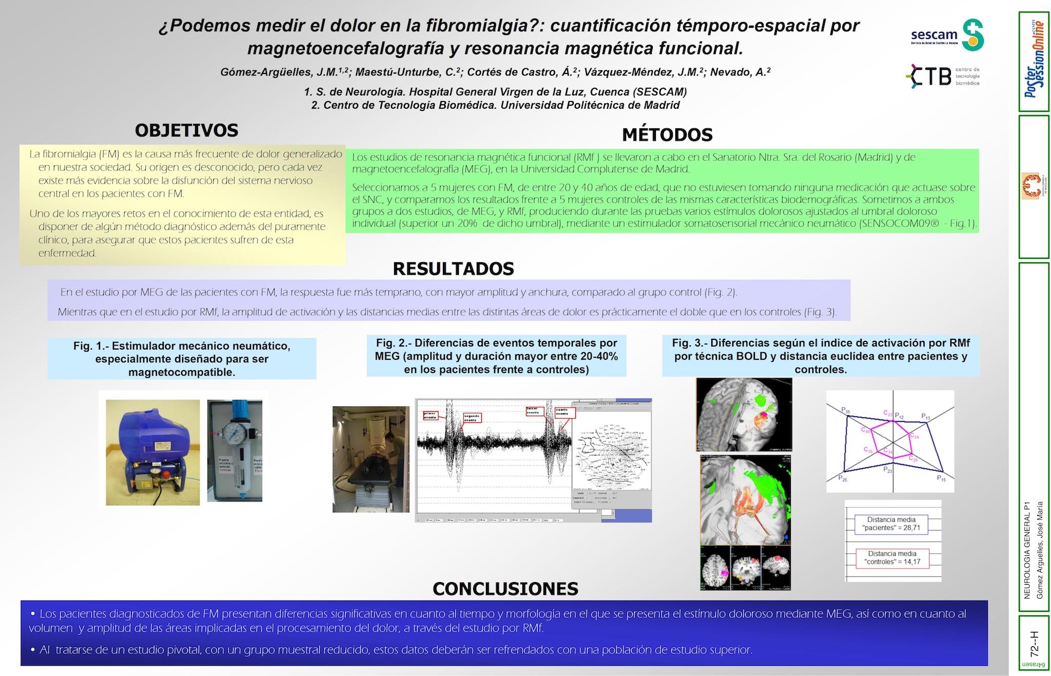 ¿Podemos medir el dolor en la fibromialgia?: cuantificación temporo-espacial por magnetoencefalografía y resonancia magnética funcional.
