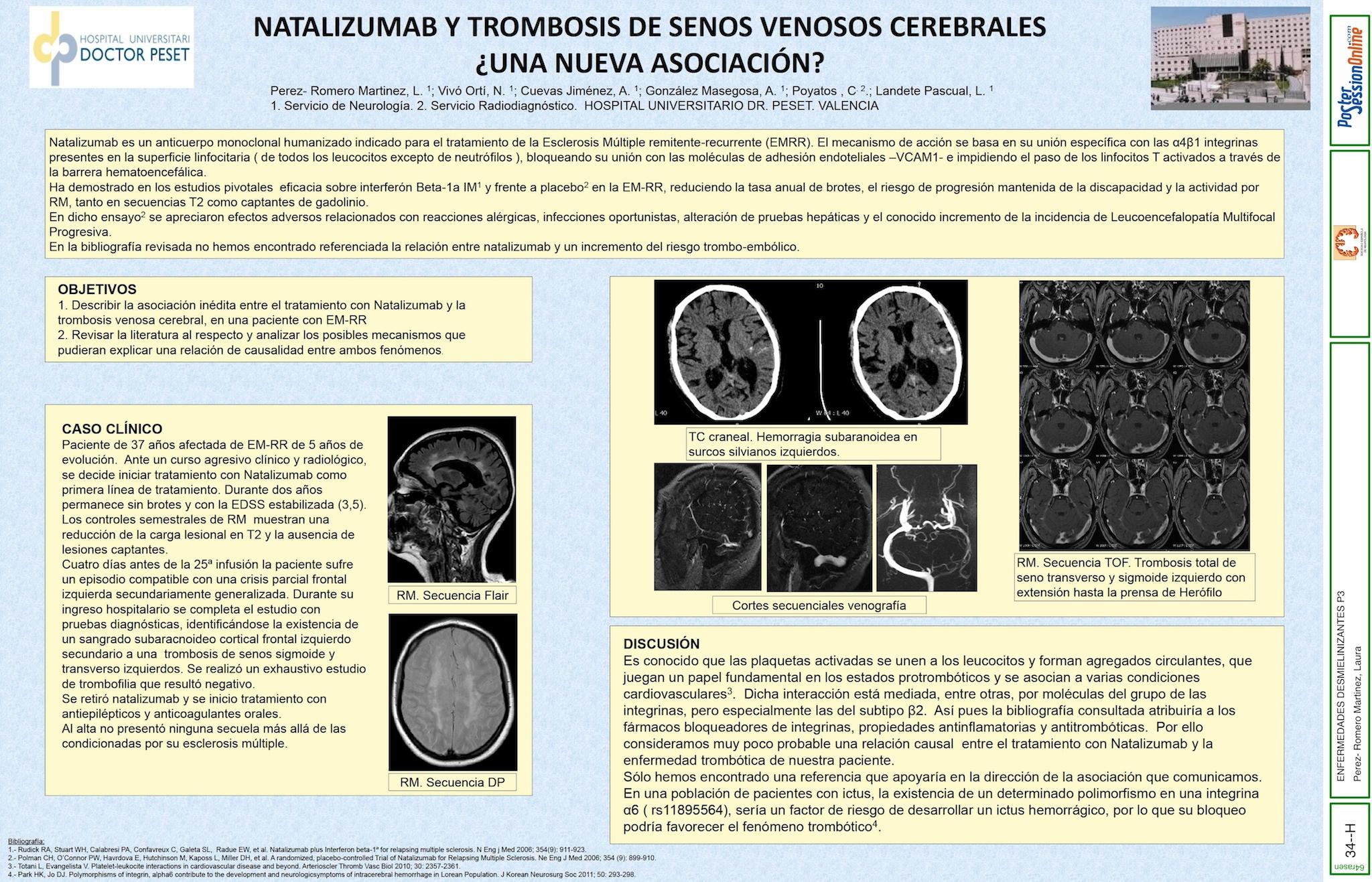 NATALIZUMAB Y  TROMBOSIS DE SENOS VENOSOS CEREBRALES ¿UNA NUEVA ASOCIACIÓN?