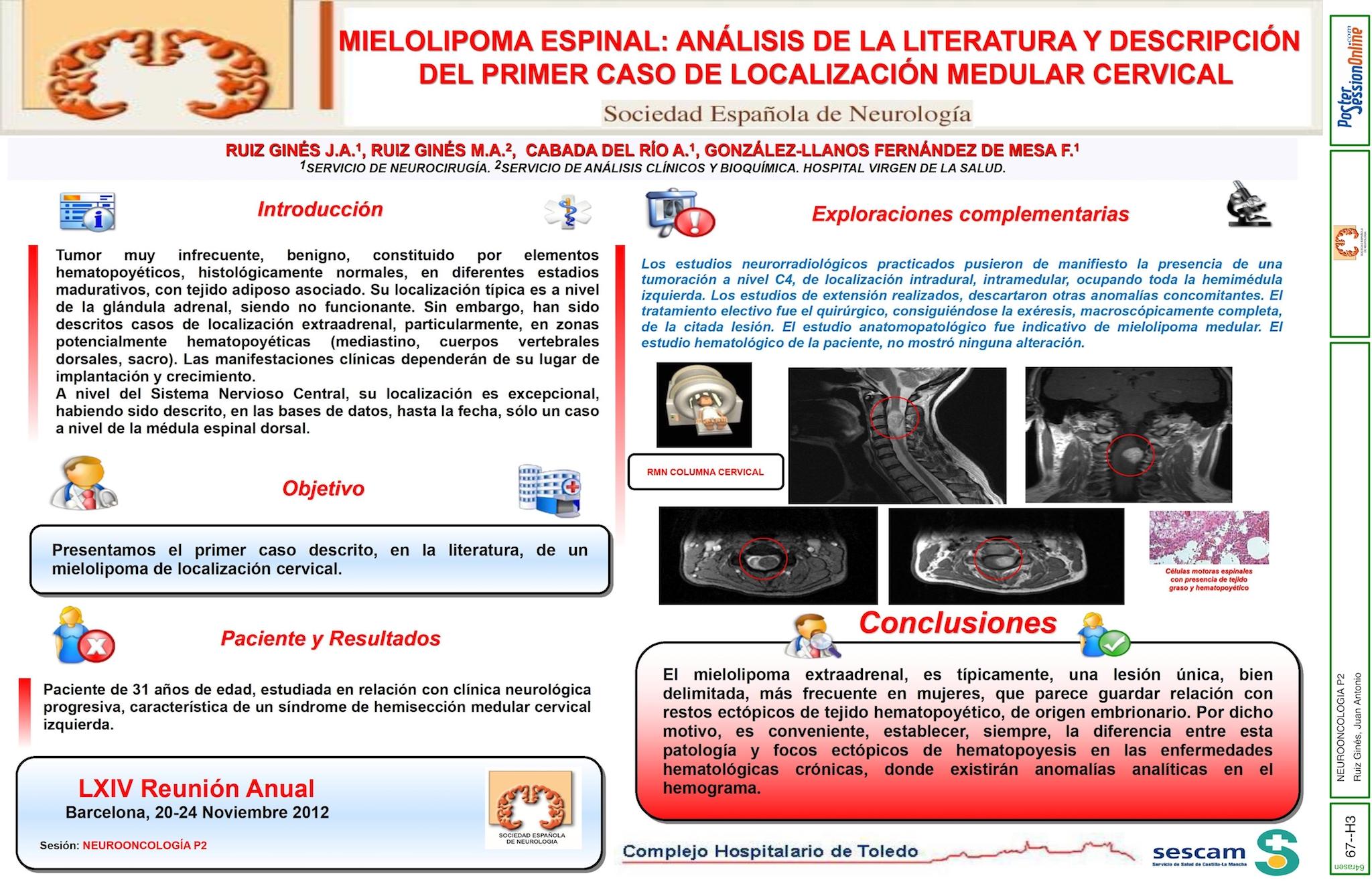 MIELOLIPOMA ESPINAL: ANÁLISIS DE LA LITERATURA Y DESCRIPCIÓN DEL PRIMER CASO DE LOCALIZACIÓN MEDULAR CERVICAL
