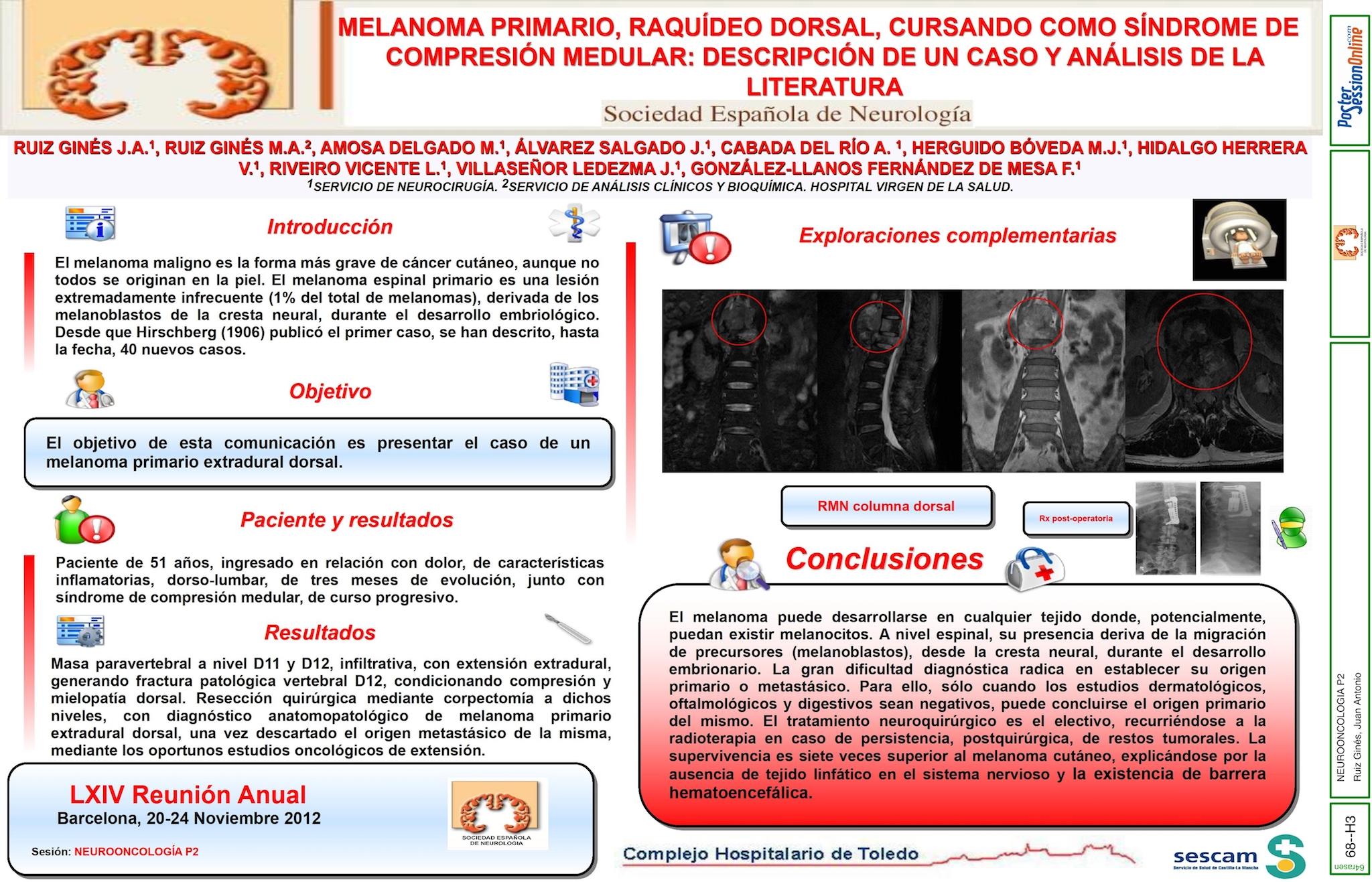 MELANOMA PRIMARIO, RAQUÍDEO DORSAL, CURSANDO COMO SÍNDROME DE COMPRESIÓN MEDULAR: DESCRIPCIÓN DE UN CASO Y ANÁLISIS DE LA LITERATURA