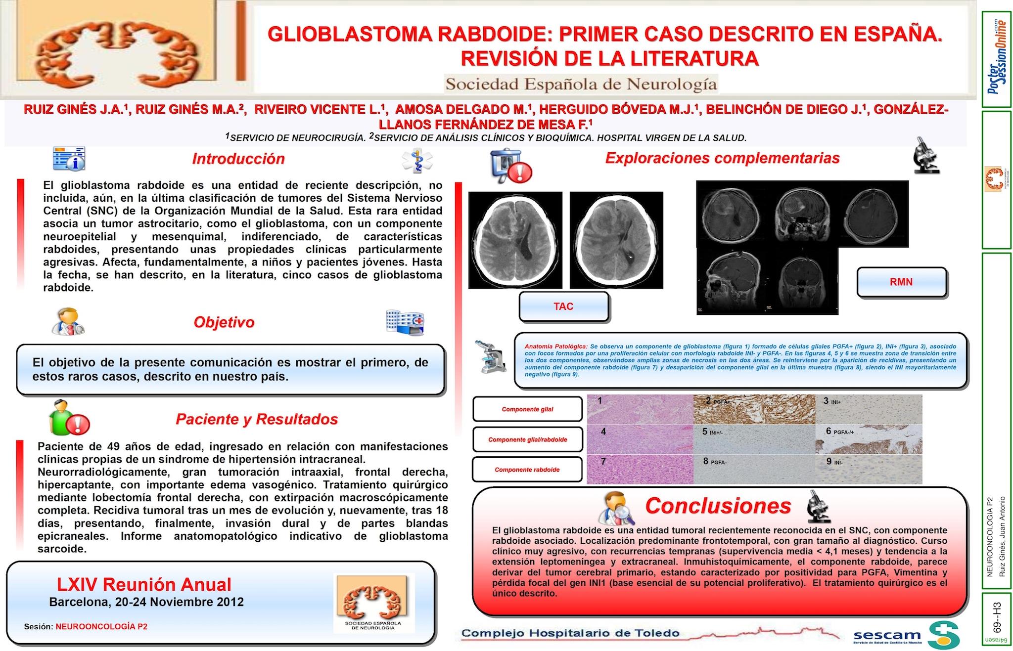 GLIOBLASTOMA RABDOIDE: PRIMER CASO DESCRITO EN ESPAÑA. REVISIÓN DE LA LITERATURA