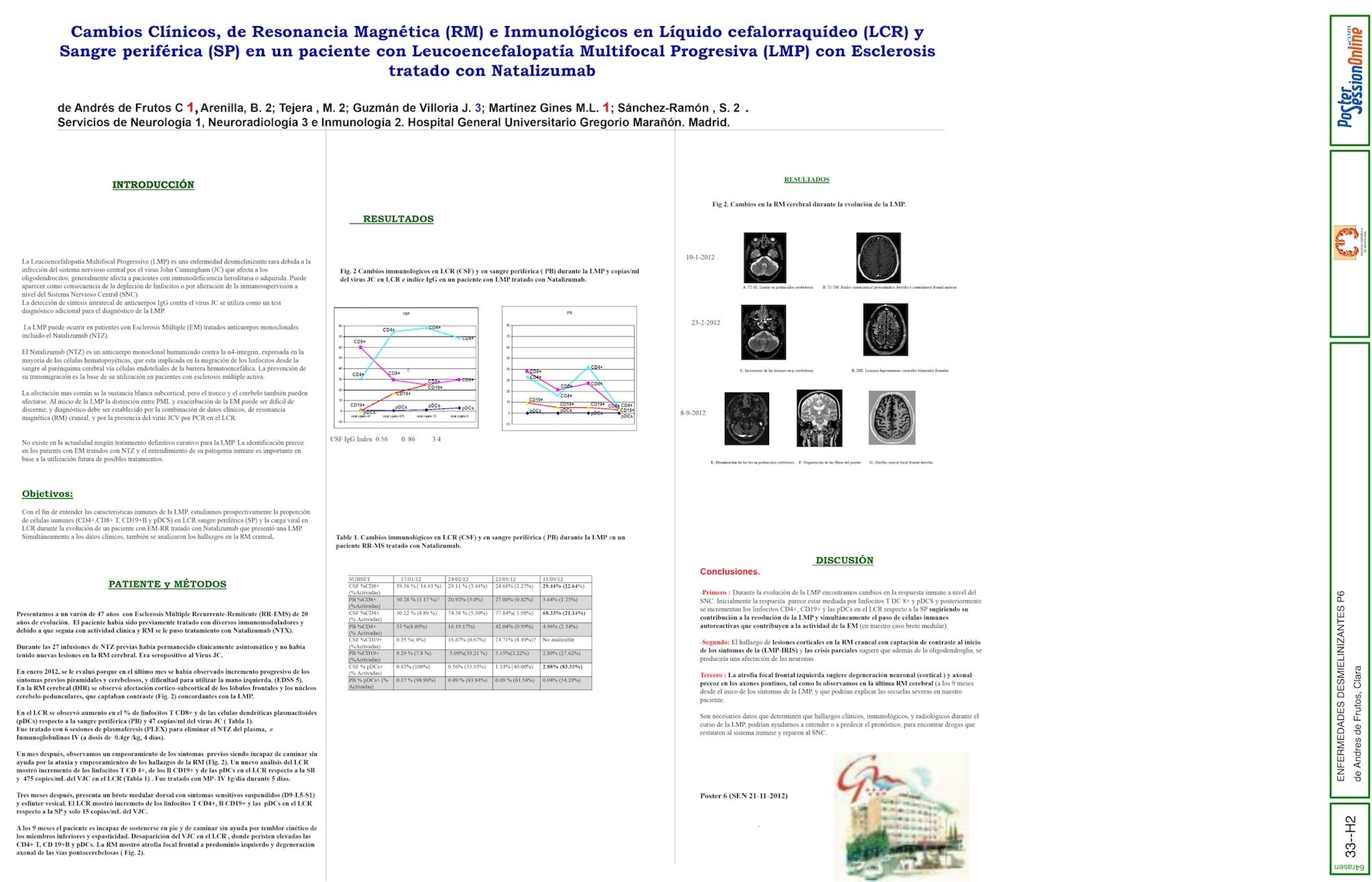 Cambios Clínicos, de Resonancia Magnética (RM) e Inmunológicos en Líquido cefalorraquídeo (LCR) y Sangre periférica (SP) en un paciente con Leucoencefalopatía Multifocal Progresiva (LMP) con Esclerosi