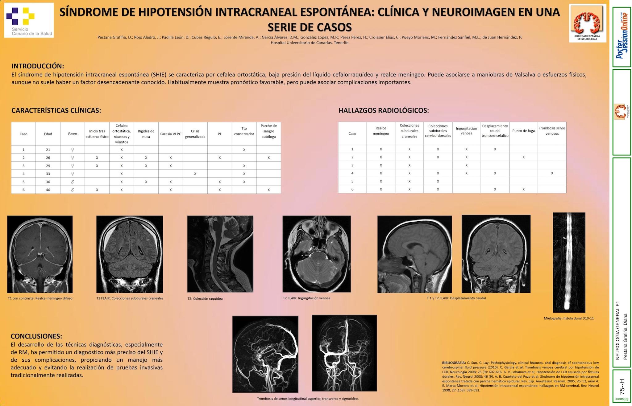 SÍNDROME DE HIPOTENSIÓN INTRACRANEAL ESPONTÁNEA: CLÍNICA Y NEUROIMAGEN EN UNA SERIE DE CASOS