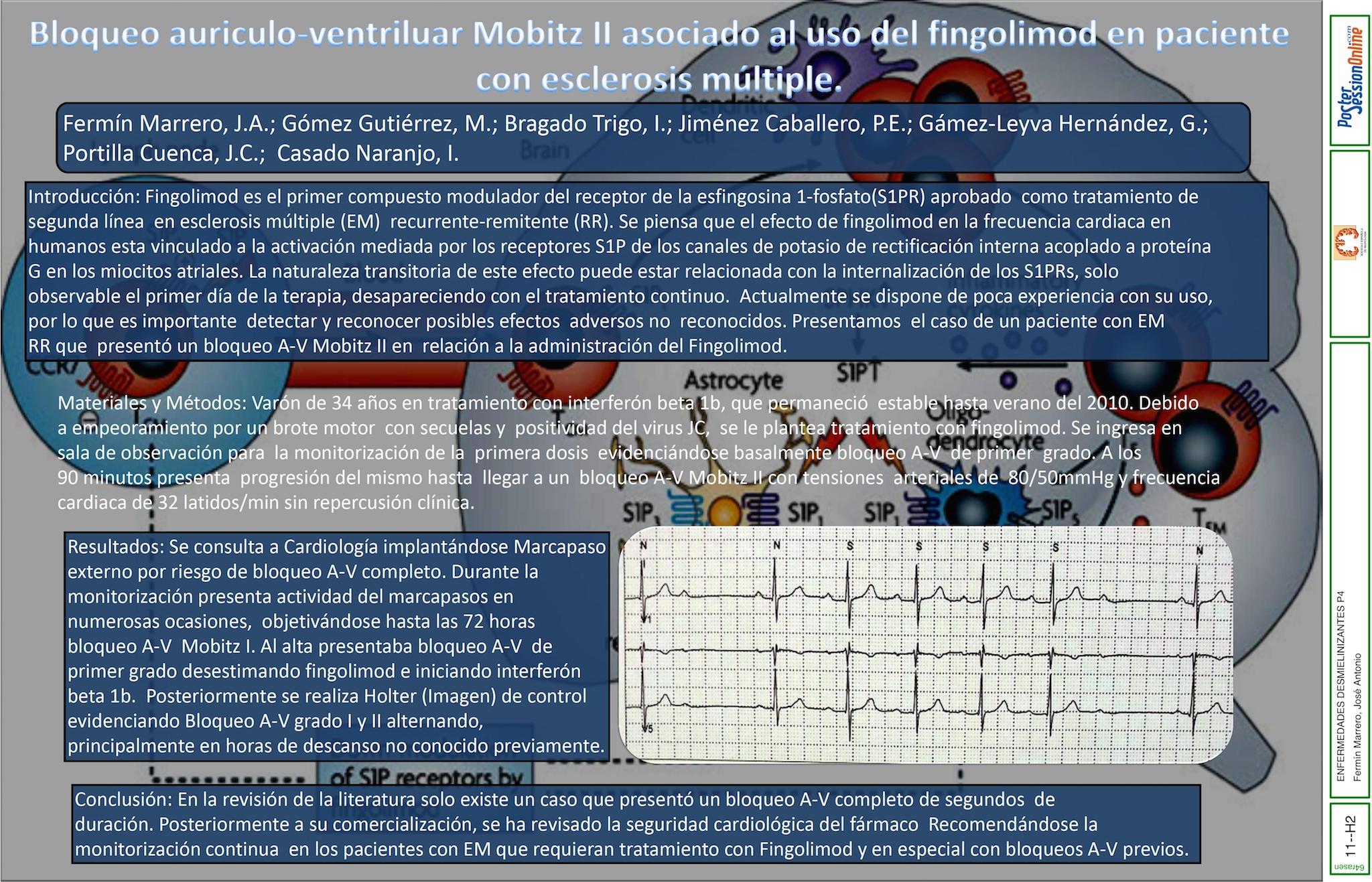 Bloqueo auriculo-ventriluar (A-V) Mobitz II  asociado al uso del fingolimod en paciente con esclerosis múltiple.