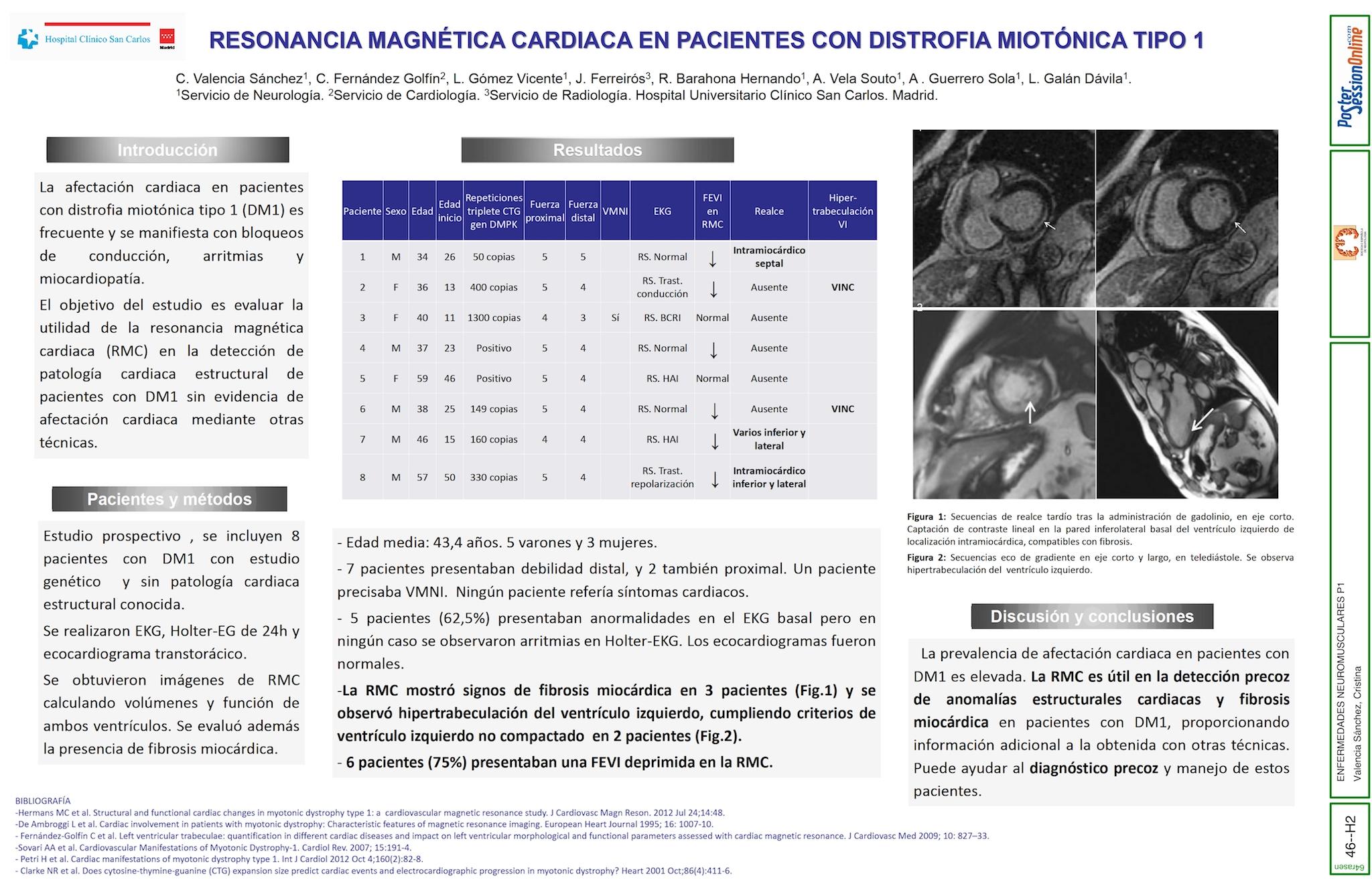 Resonancia magnética cardiaca en pacientes con distrofia miotónica tipo 1