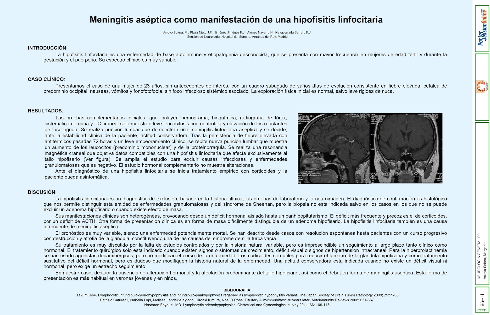 Meningitis aséptica como manifestación de una hipofisitis linfocitaria