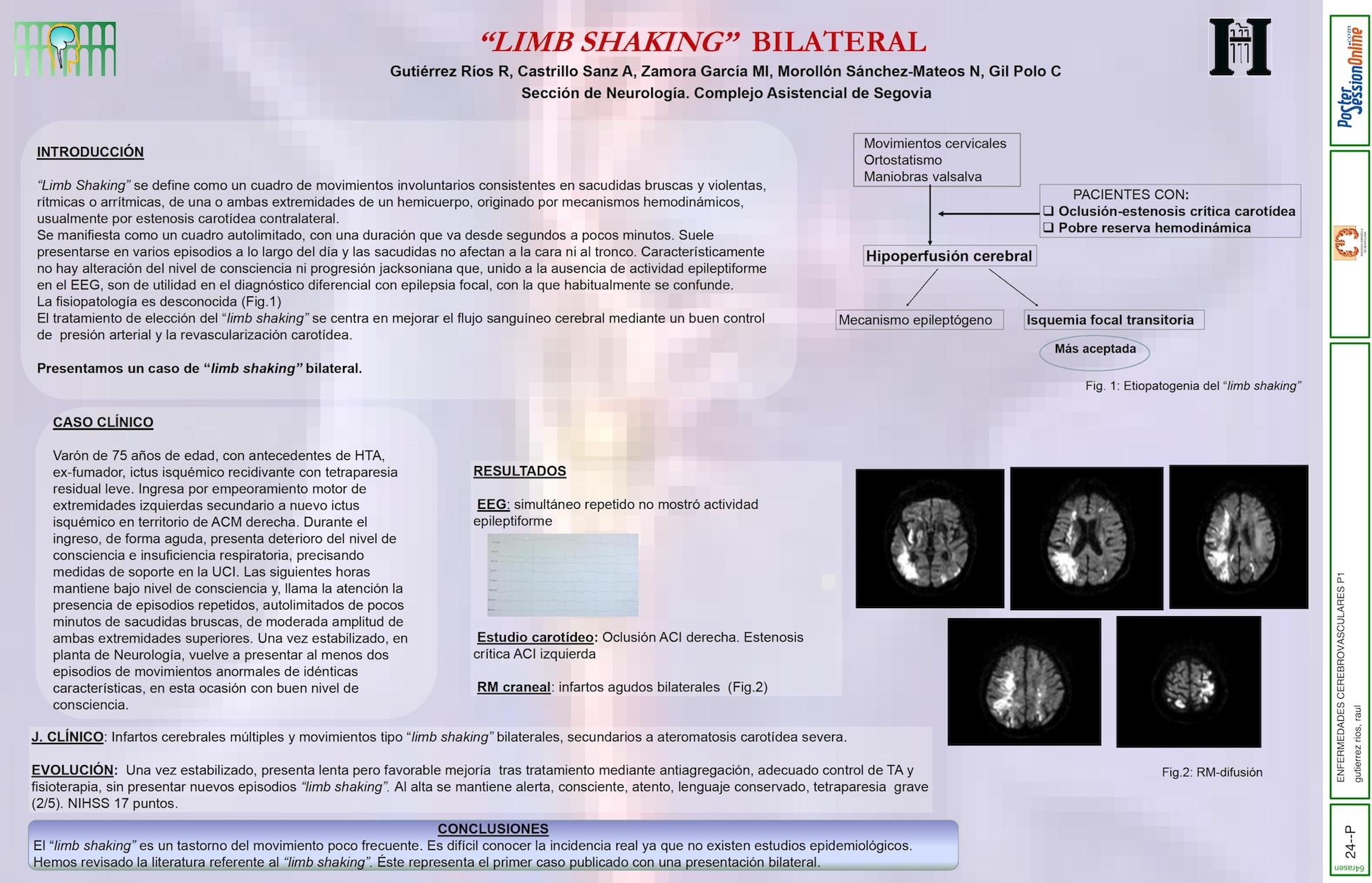 "limb shaking" bilateral