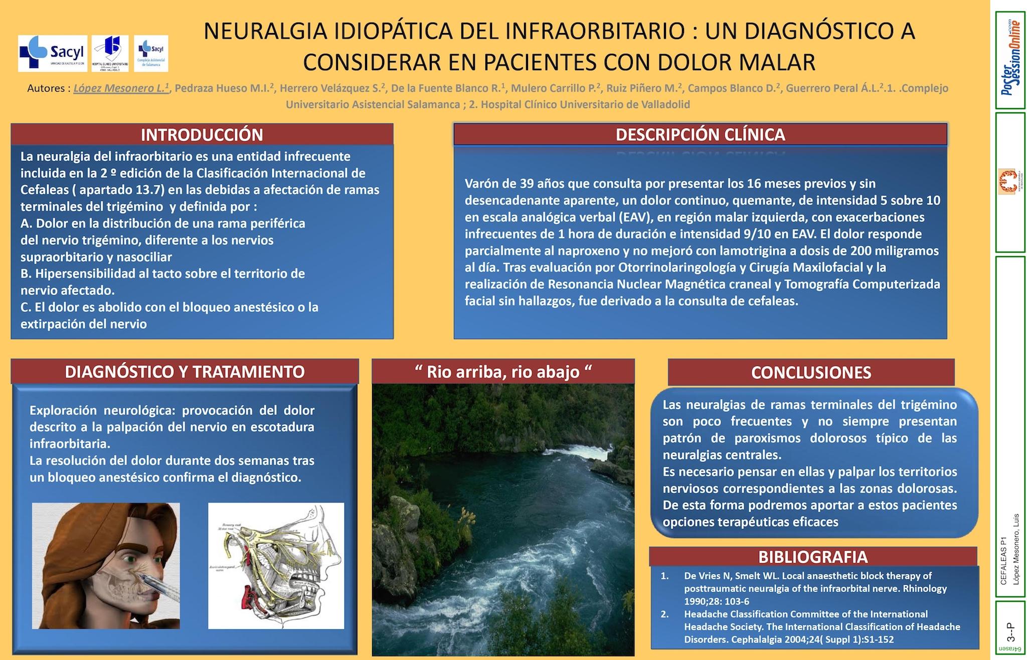 NEURALGIA IDIOPÁTICA DEL INFRAORBITARIO: UN DIAGNÓSTICO A CONSIDERAR EN PACIENTES CON DOLOR MALAR