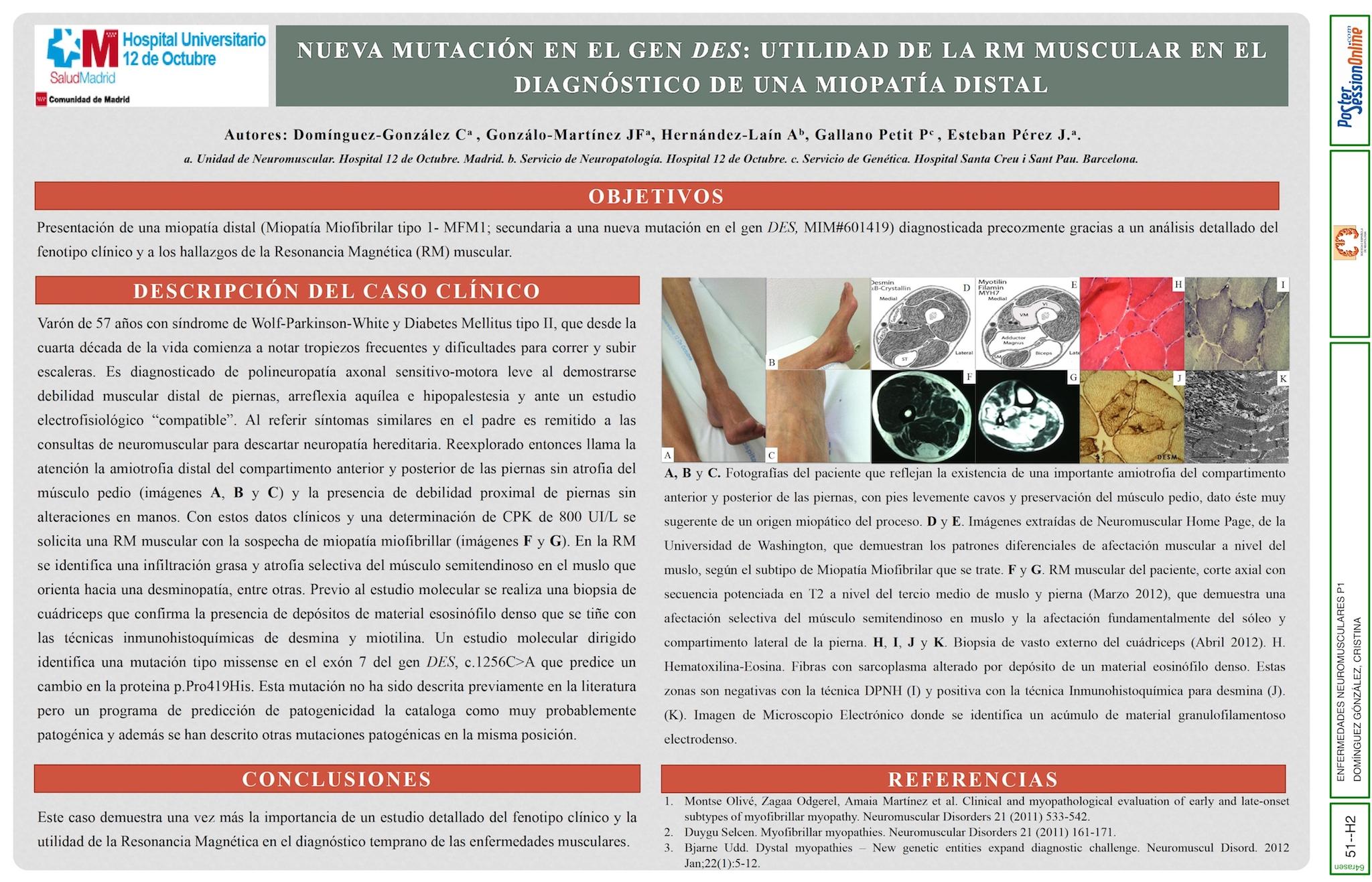 NUEVA MUTACIÓN EN EL GEN DE LA DESMINA: UTILIDAD DE LA RM MUSCULAR EN EL DIAGNÓSTICO DE UNA MIOPATÍA DISTAL