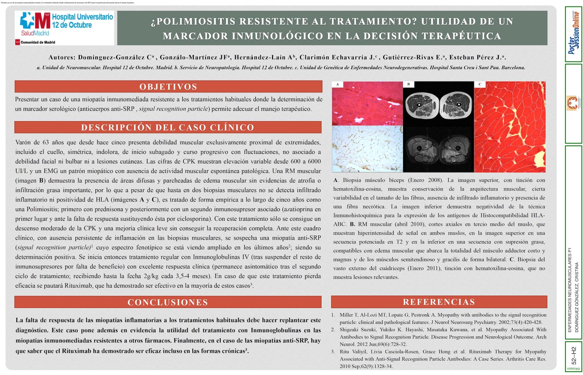 ¿POLIMIOSITIS RESISTENTE AL TRATAMIENTO? UTILIDAD DE UN MARCADOR INMUNOLÓGICO EN LA DECISIÓN TERAPÉUTICA
