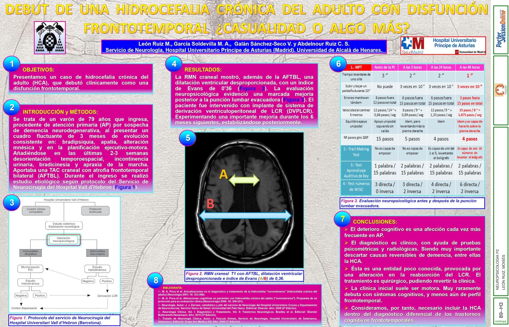 DEBUT DE UNA HICROCEFALIA CRÓNICA DEL ADULTO CON DISFUNCIÓN FRONTOTEMPORAL ¿CASUALIDAD O ALGO MÁS?