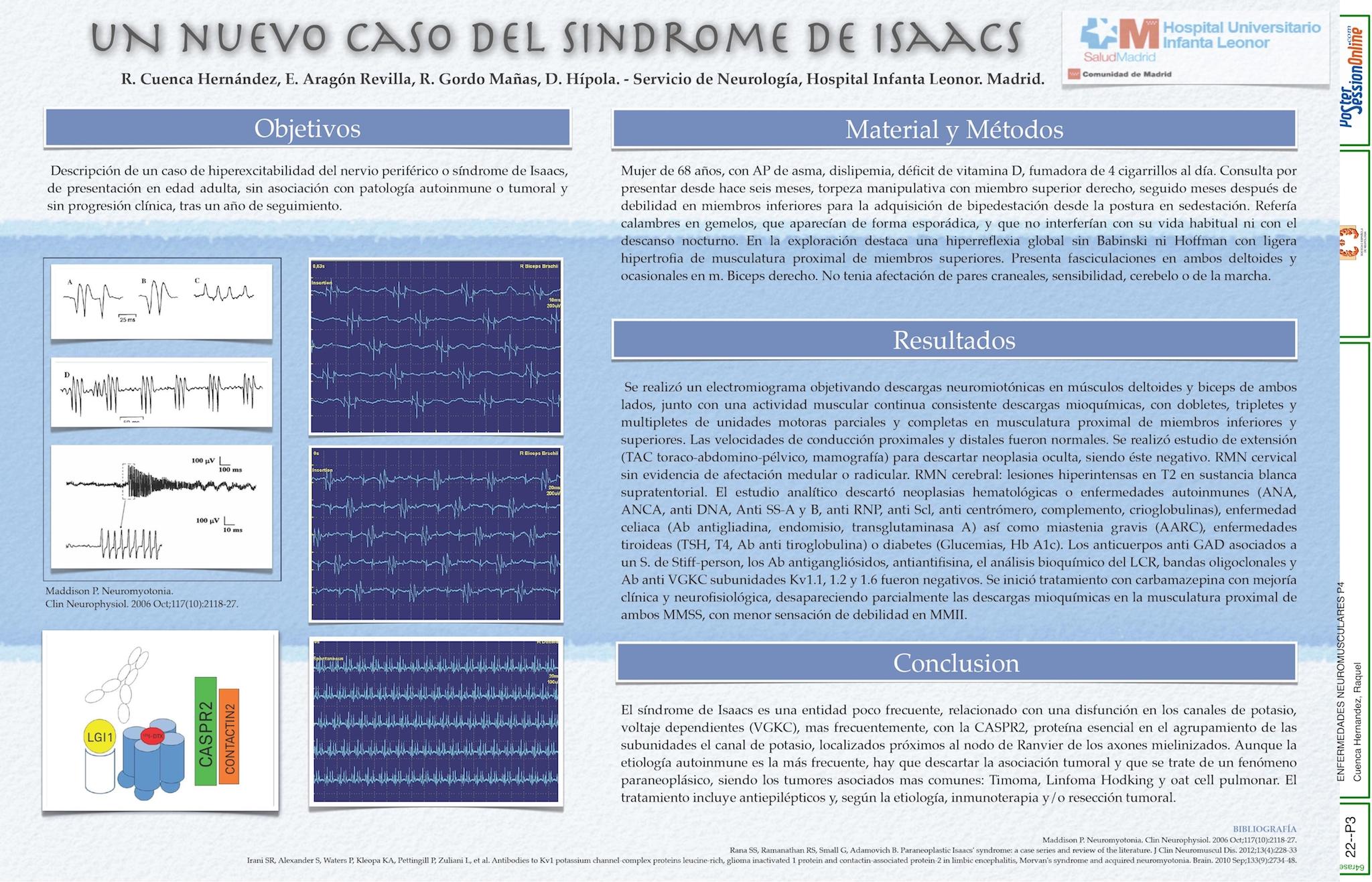 Un nuevo caso de síndrome de Isaacs