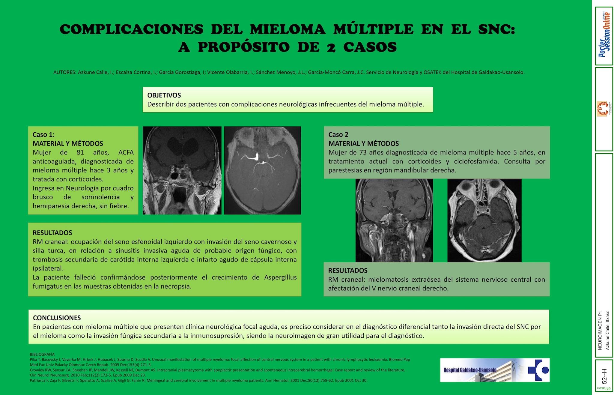 COMPLICACIONES DEL MIELOMA MÚLTIPLE EN EL SNC: A PROPÓSITO DE 2 CASOS