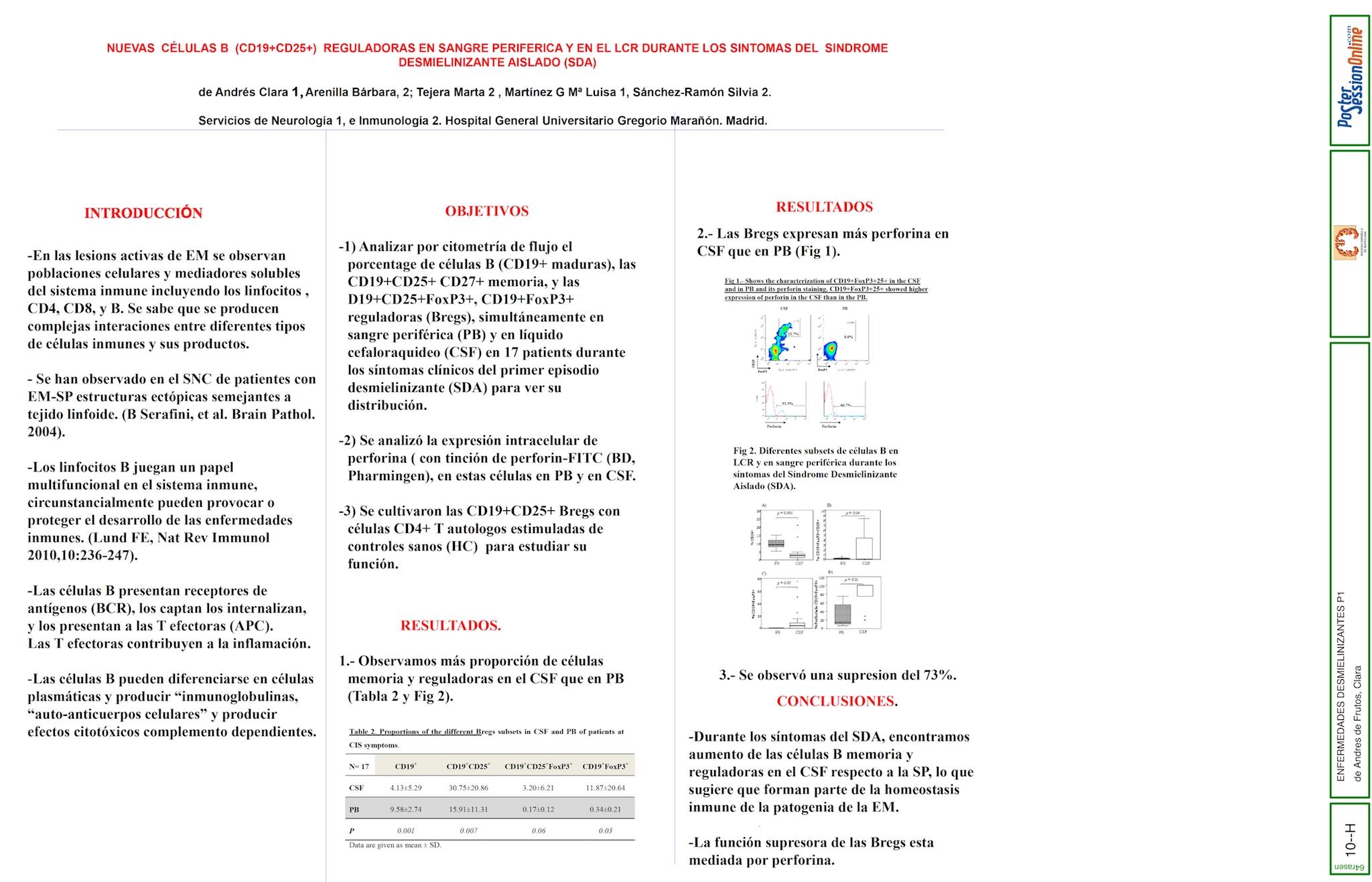 Células CD19+CD25+ B reguladoras en sangre periférica y liquido cefalorraquídeo (LCR) durante el síndrome desmielinizante aislado (SDA).