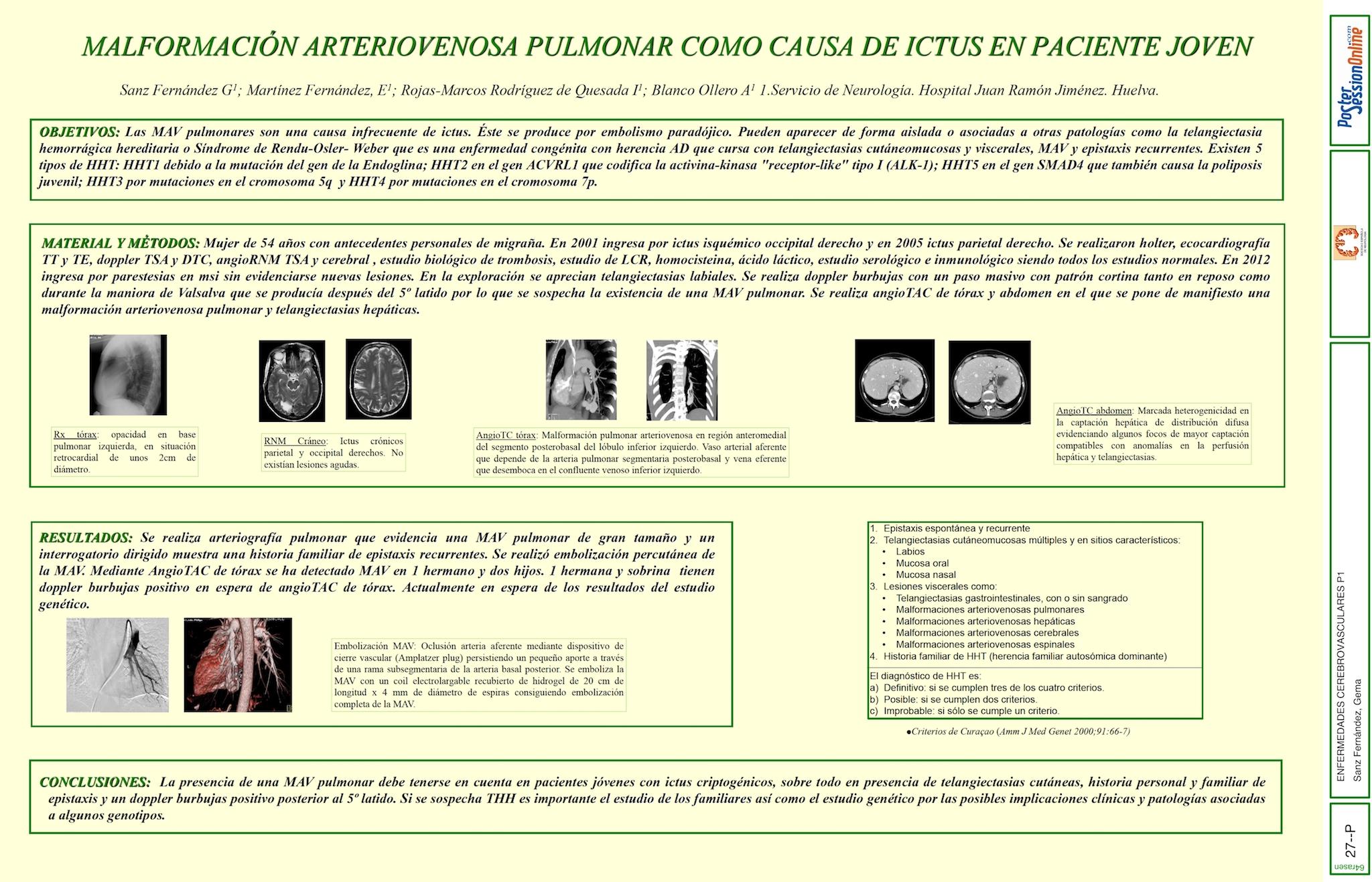 MALFORMACIÓN ARTERIOVENOSA PULMONAR COMO CAUSA DE ICTUS EN PACIENTE JOVEN