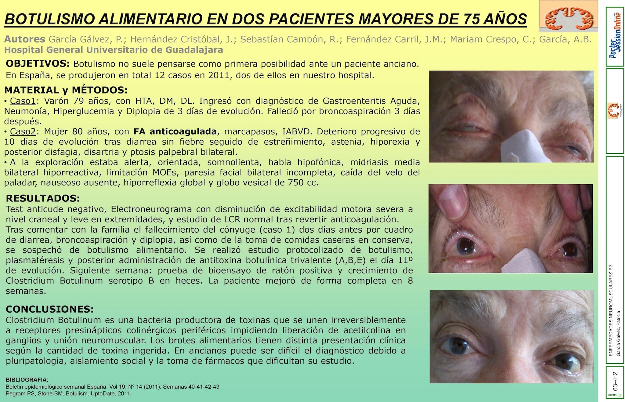 Botulismo alimentario en dos pacientes mayores de 75 años