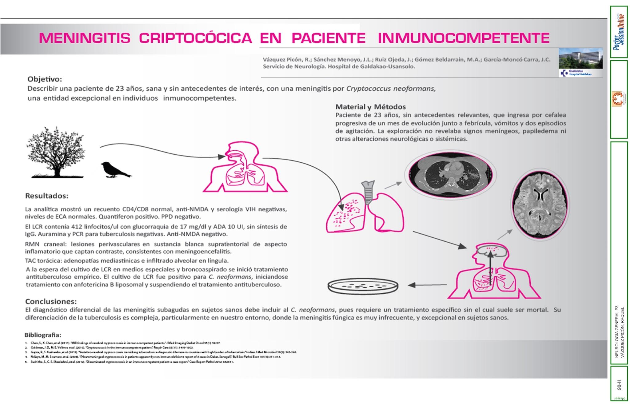MENINGITIS CRIPTOCÓCICA EN PACIENTE INMUNOCOMPETENTE