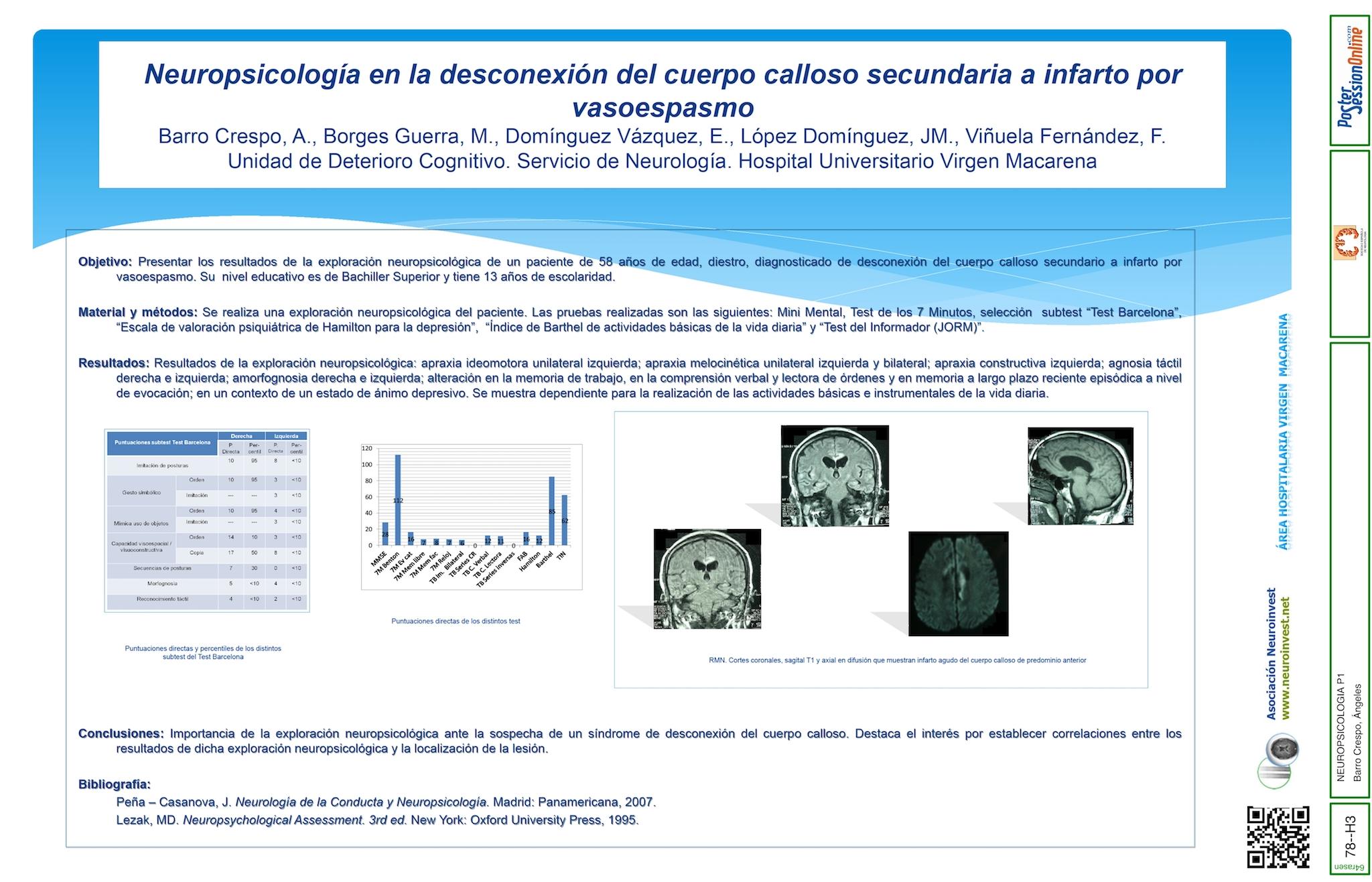 Neuropsicología en la desconexión del cuerpo calloso secundaria a infarto por vasoespasmo.