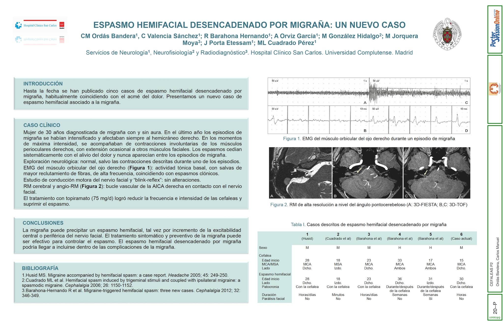 Espasmo hemifacial desencadenado por migraña: un nuevo caso