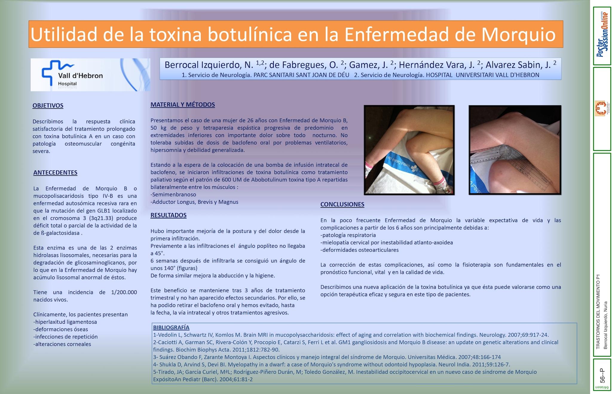 Utilidad de la toxina botulínica en la Enfermedad de Morquio.