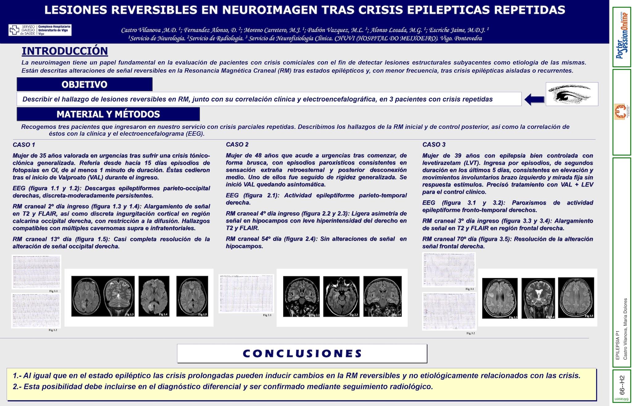 LESIONES REVERSIBLES EN NEUROIMAGEN TRAS CRISIS EPILEPTICAS REPETIDAS