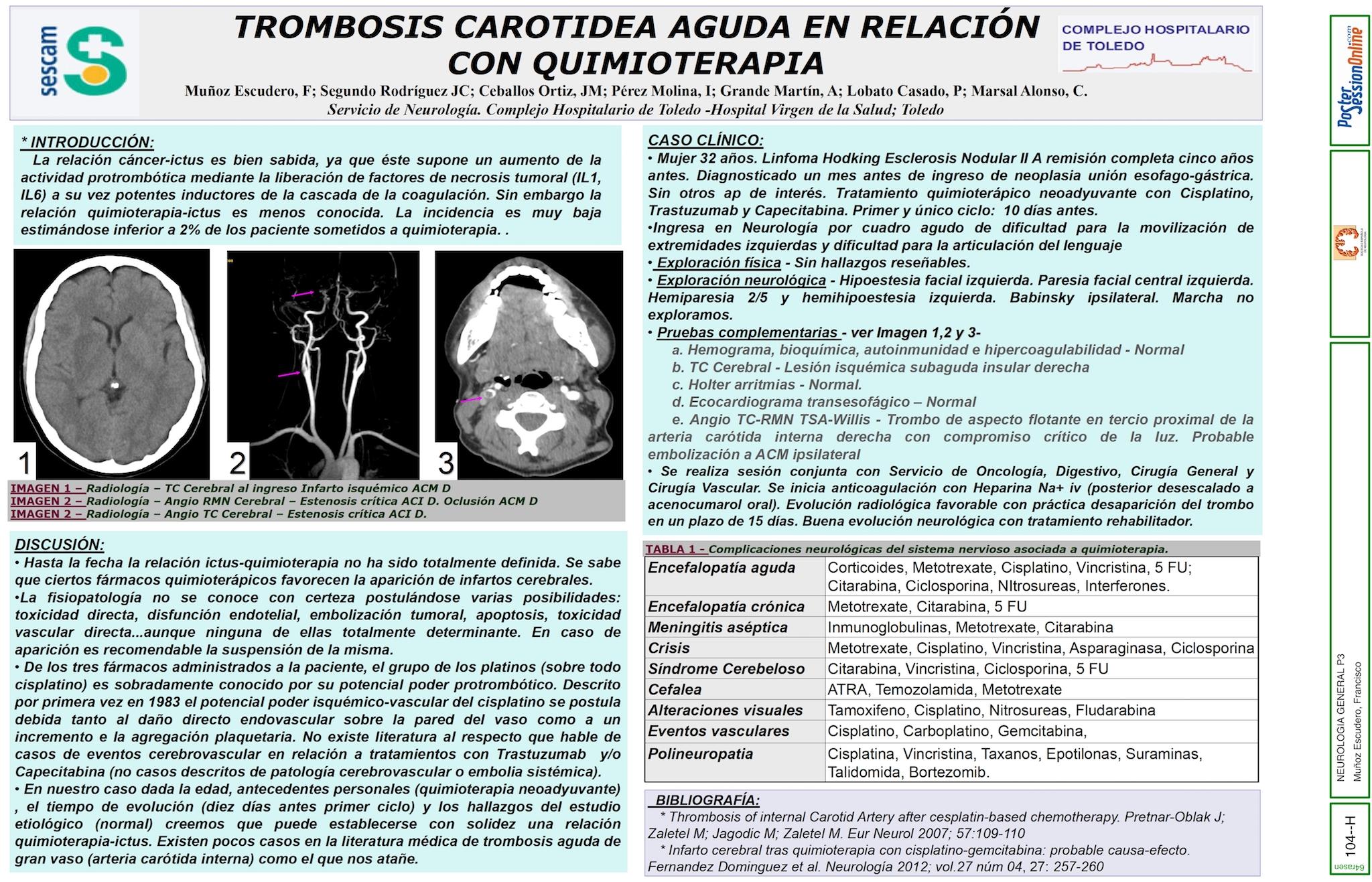 TROMBOSIS CAROTIDEA AGUDA EN RELACIÓN CON QUIMIOTERAPIA