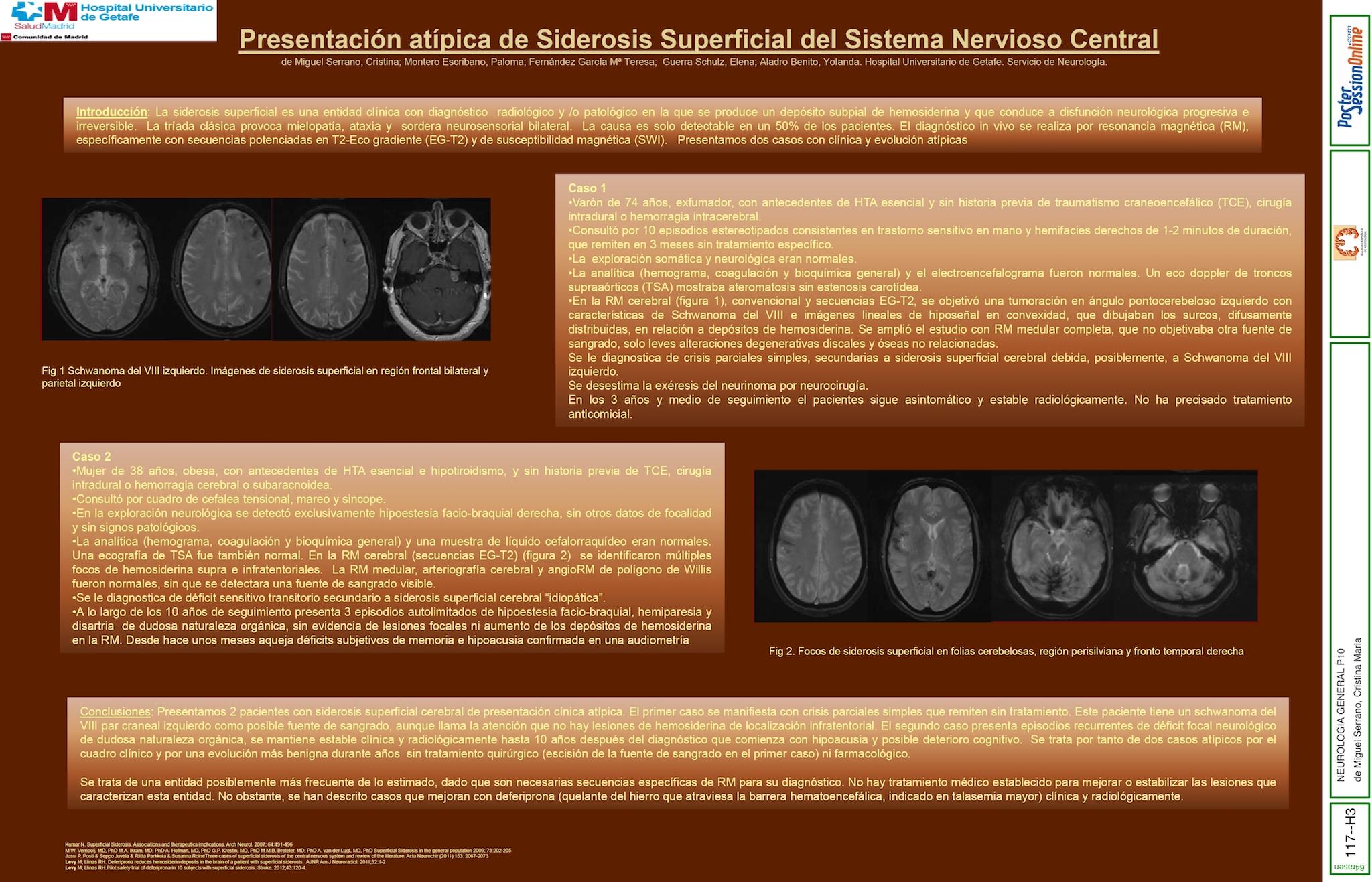 Presentación atípica de  Siderosis Superficial del Sistema Nervioso Central