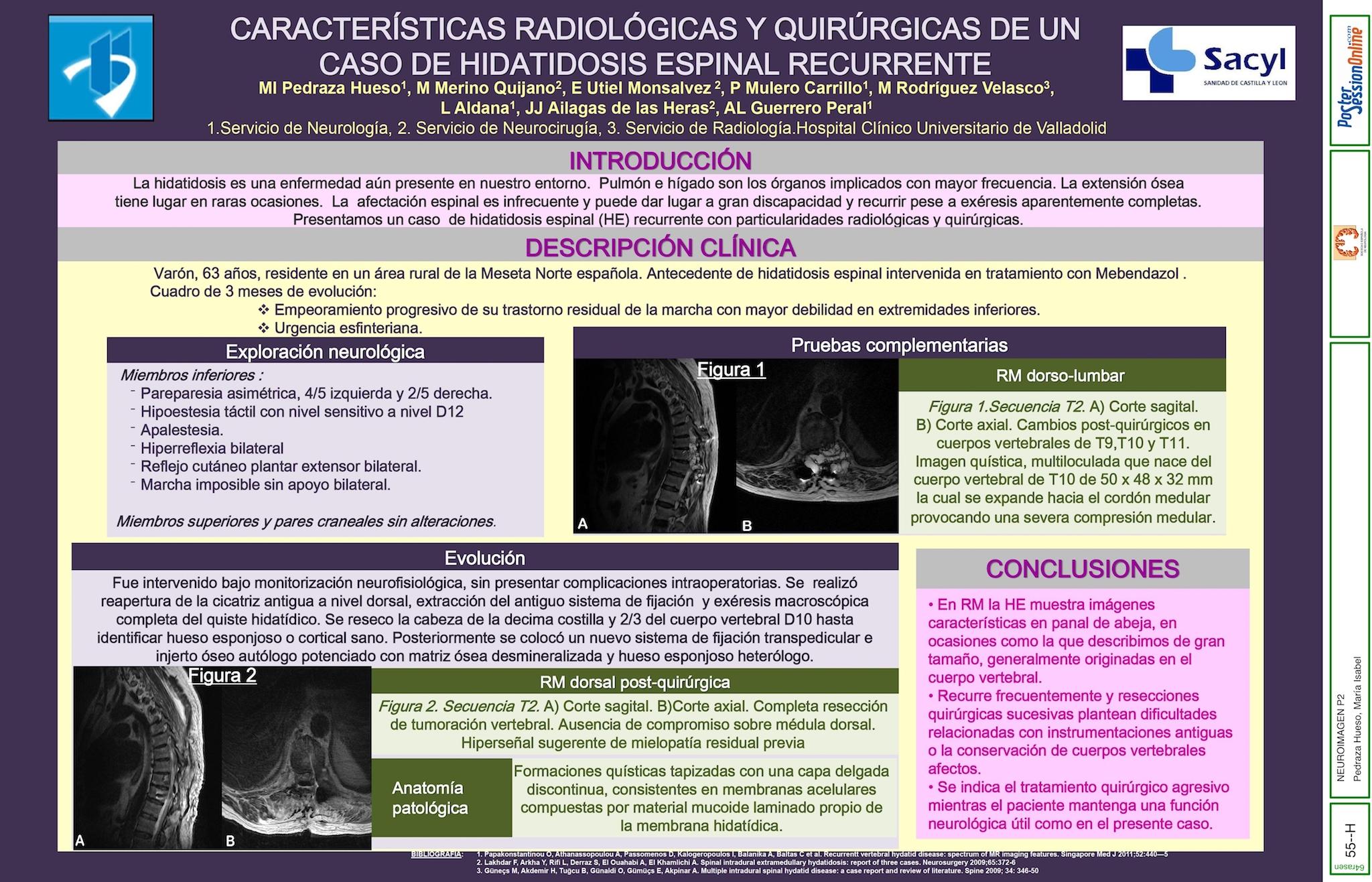 CARACTERÍSTICAS RADIOLÓGICAS Y QUIRÚRGICAS DE UN CASO DE HIDATIDOSIS ESPINAL RECURRENTE