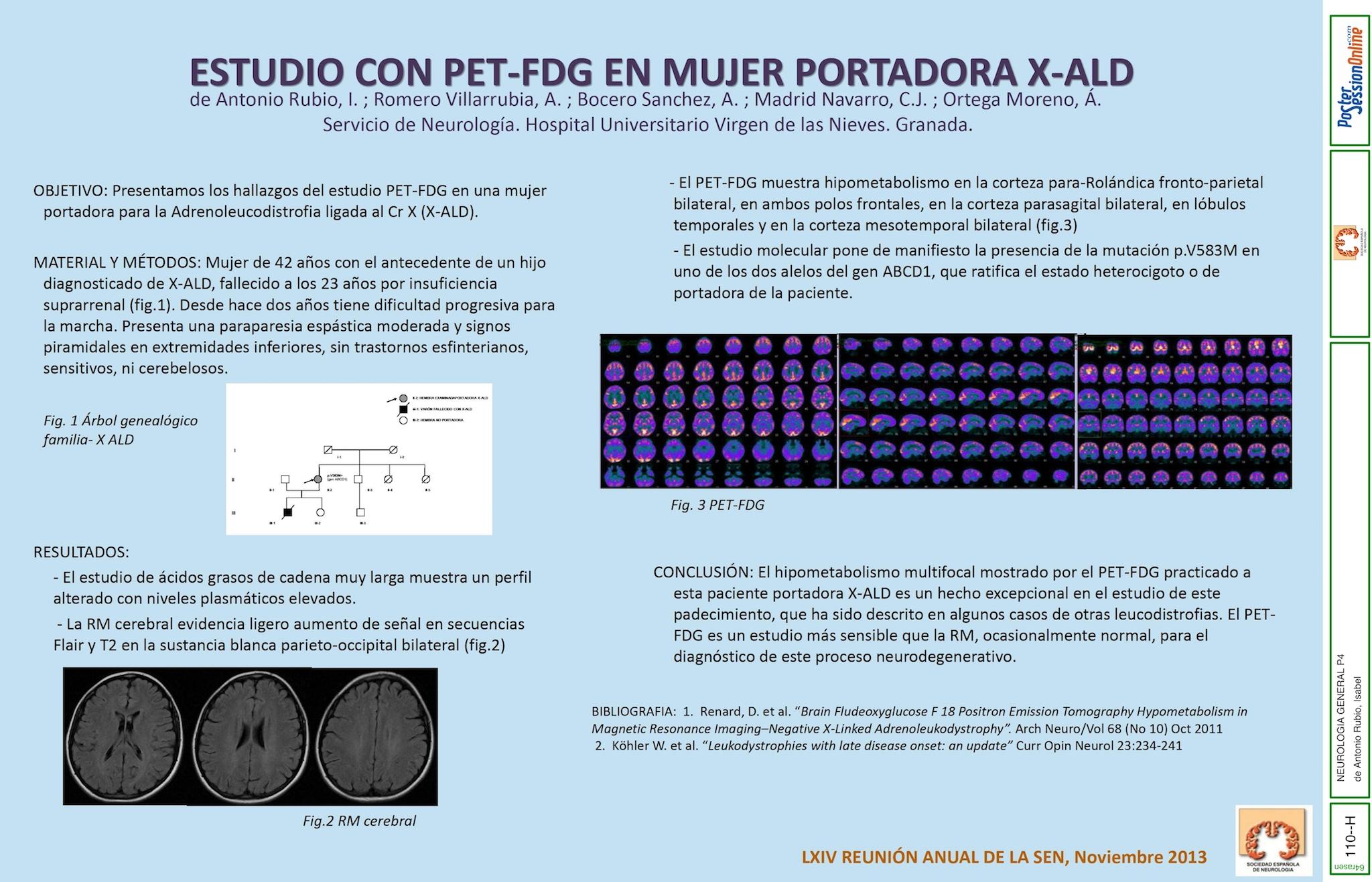 ESTUDIO CON PET-FDG EN MUJER PORTADORA X-ALD