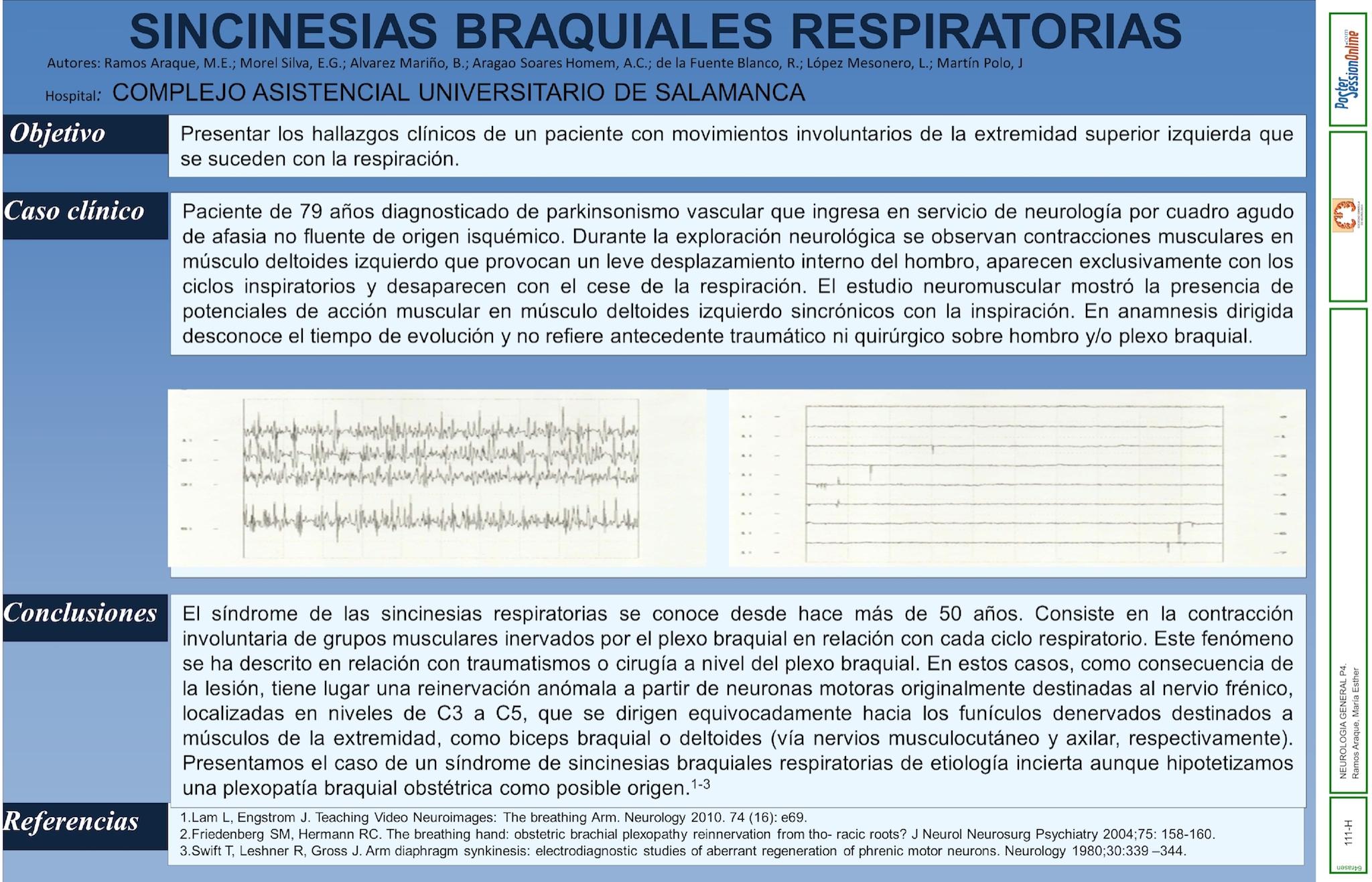 Sincinesias braquiales respiratorias