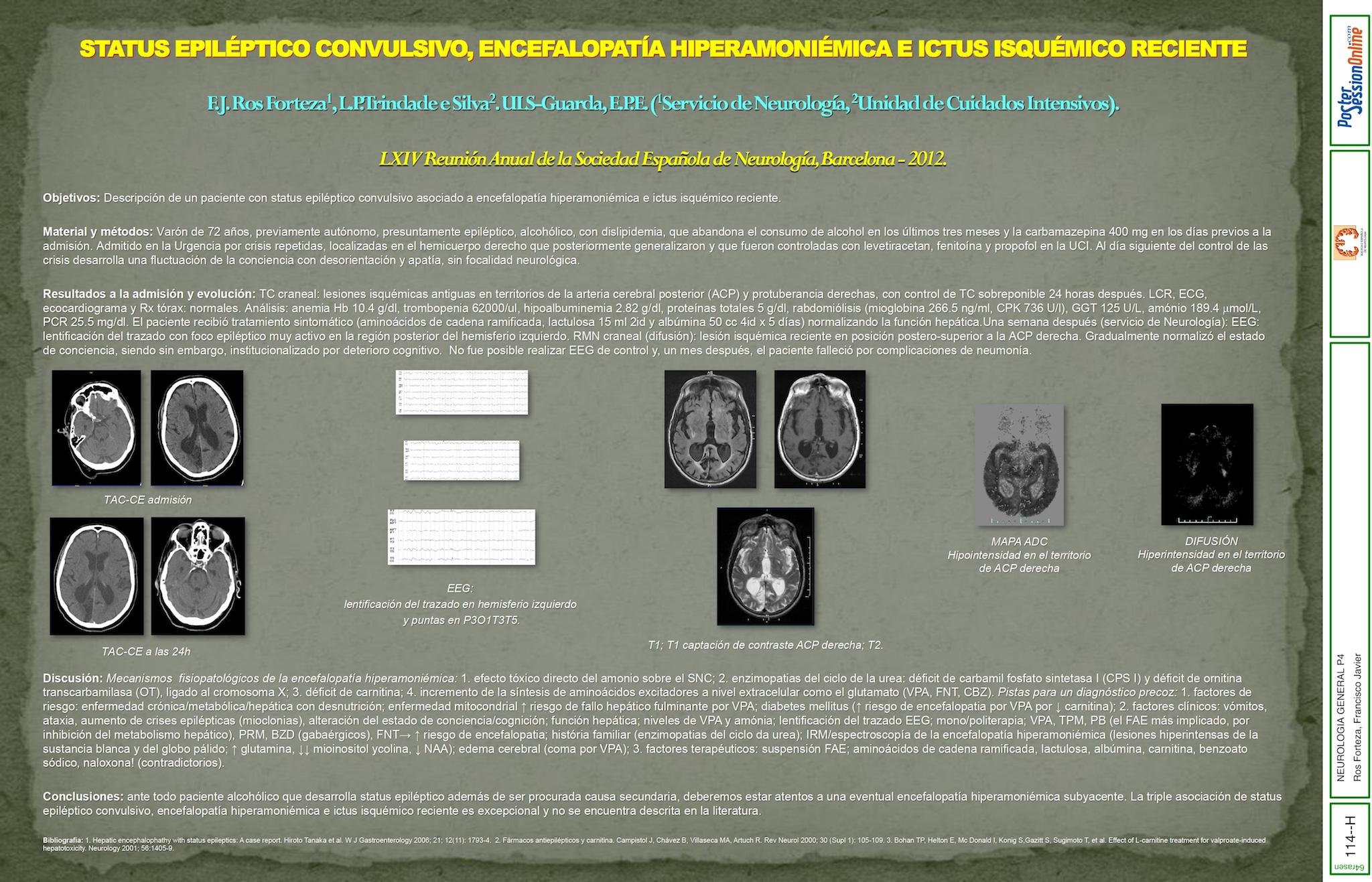 STATUS EPILÉPTICO CONVULSIVO, ENCEFALOPATIA HIPERAMONIÉMICA E ICTUS ISQUÉMICO RECIENTE