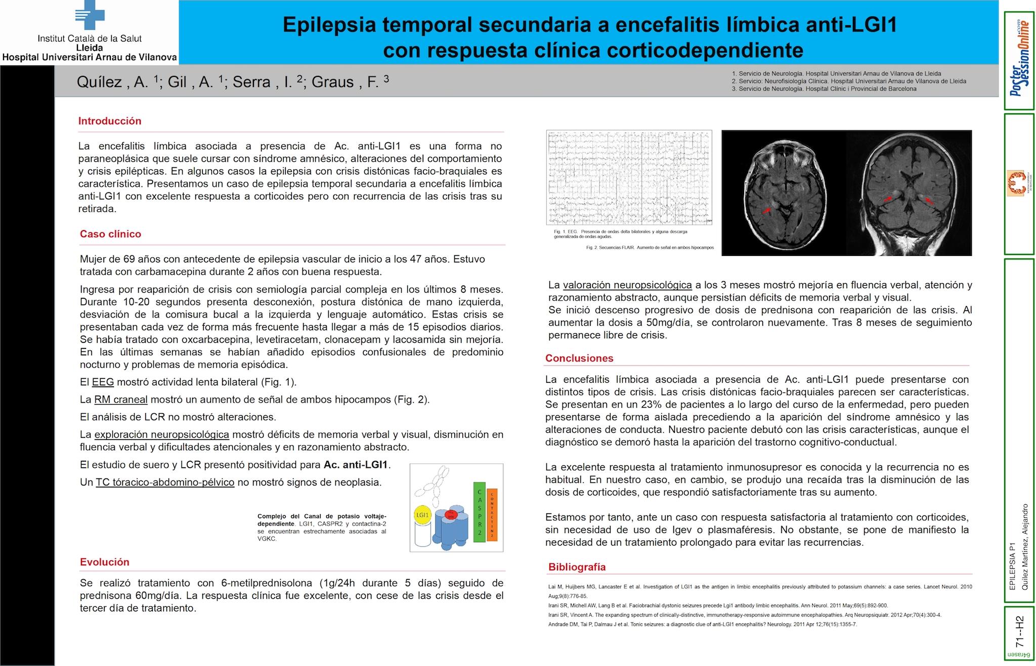 Epilepsia temporal secundaria a encefalitis  límbica anti-LGI1 con respuesta clínica corticodependiente
