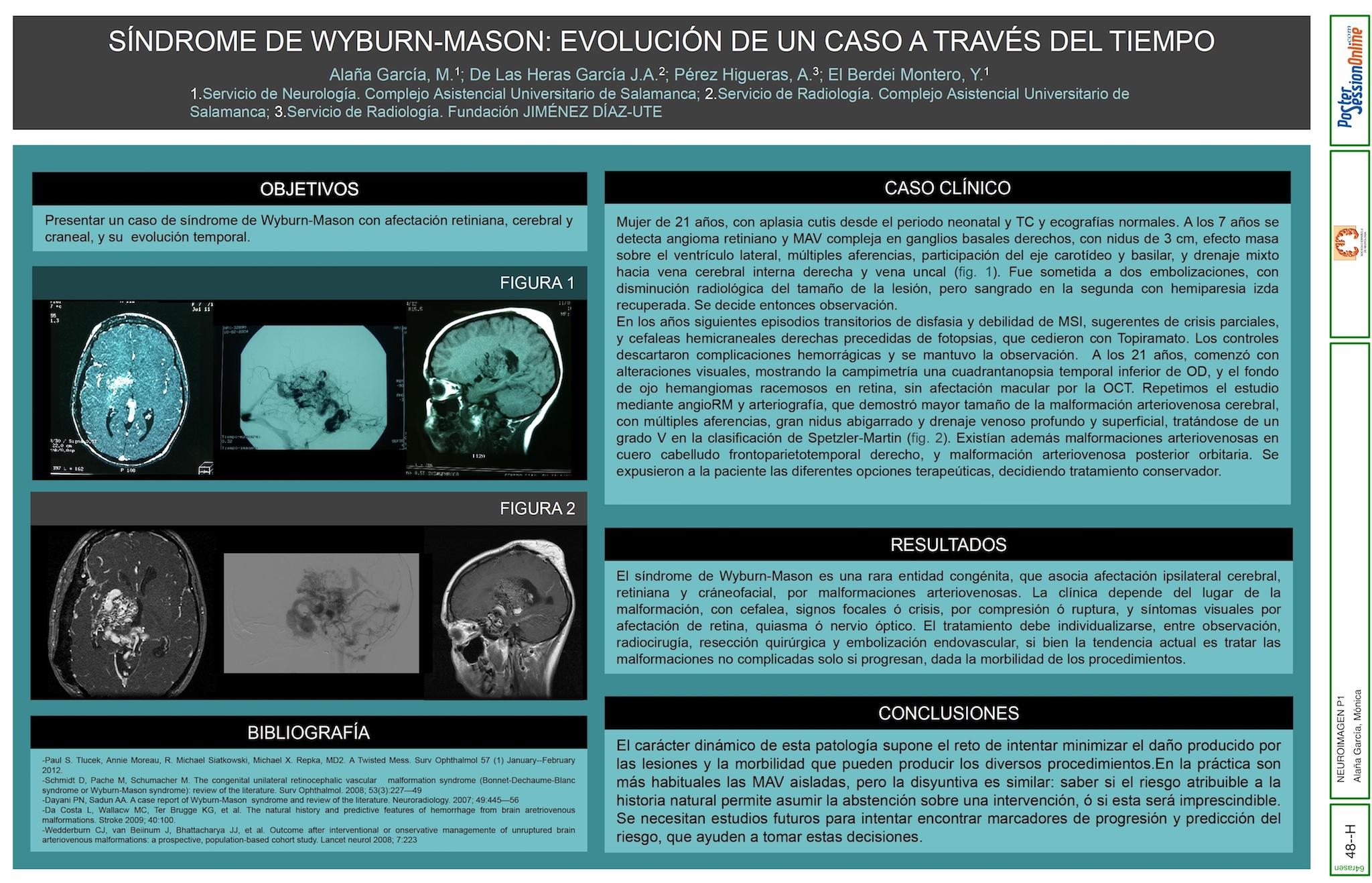 SINDROME DE WYBURN-MASON: EVOLUCION DE UN CASO A TRAVES DEL TIEMPO
