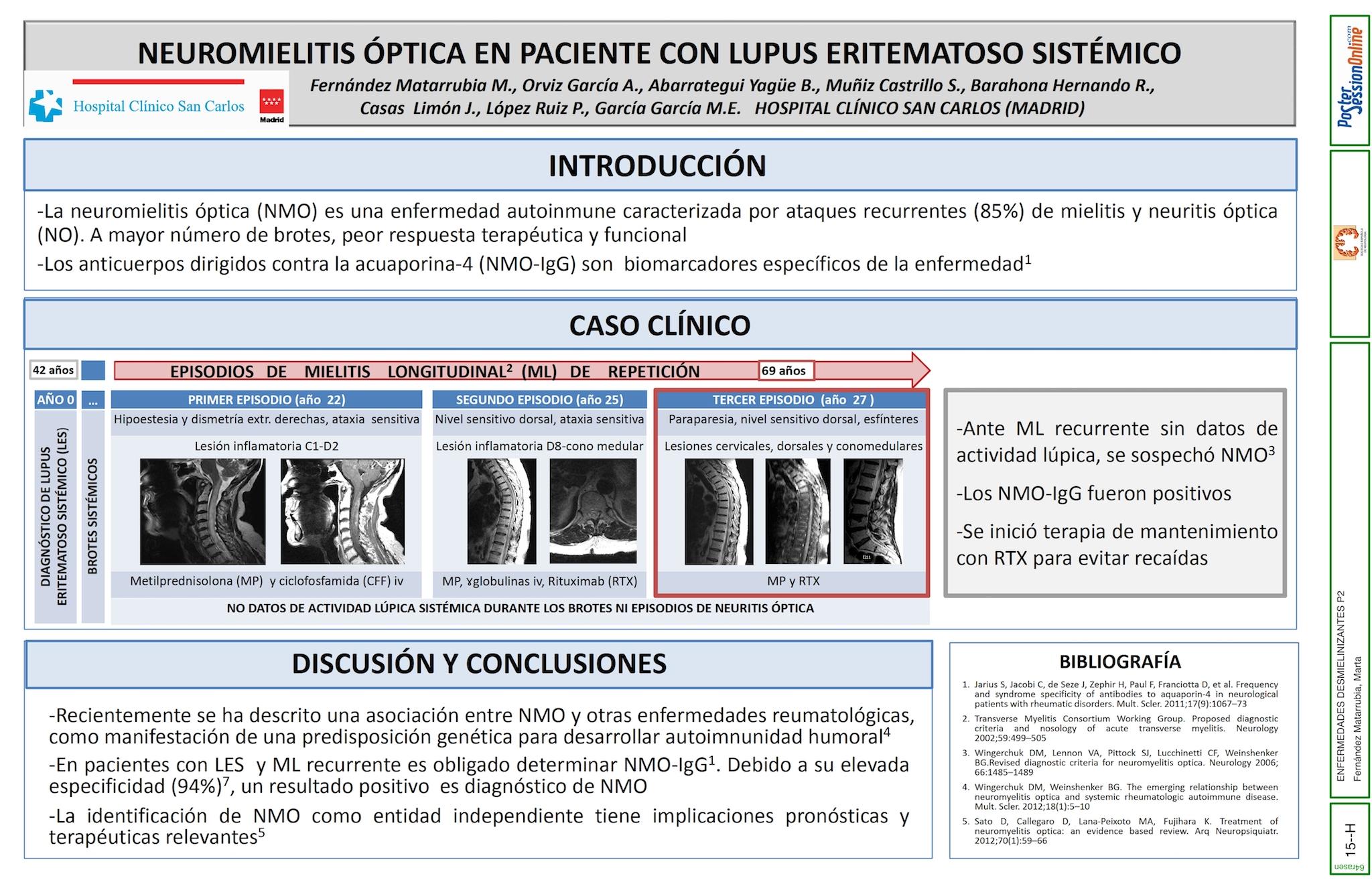 NEUROMIELITIS ÓPTICA (NMO) EN PACIENTE CON LUPUS ERITEMATOSO SISTÉMICO (LES)