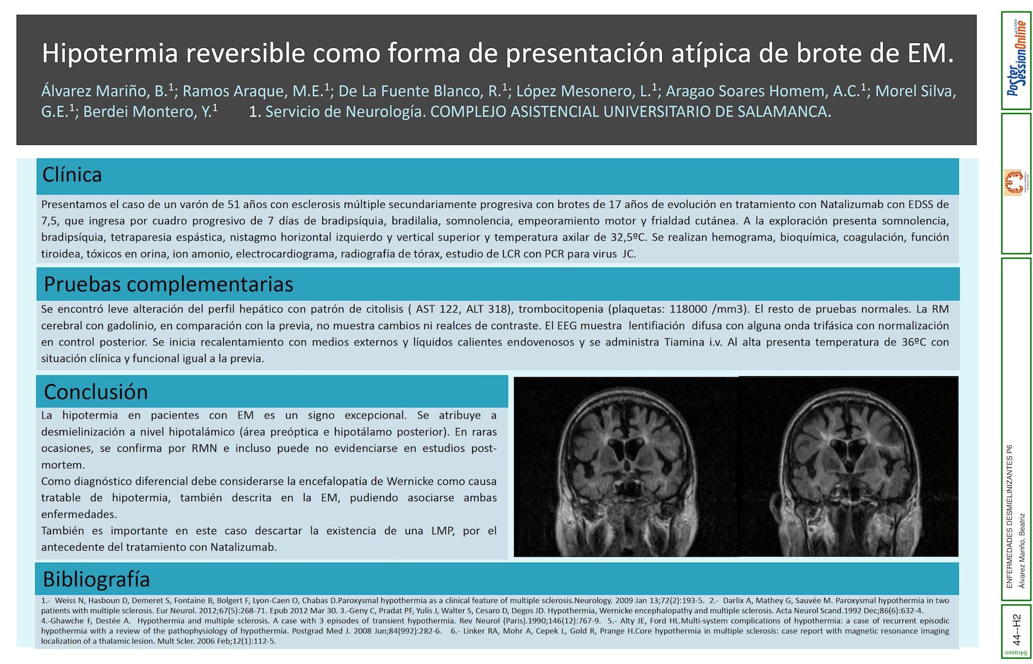 Hipotermia reversible como forma de presentación atípica de brote de EM.