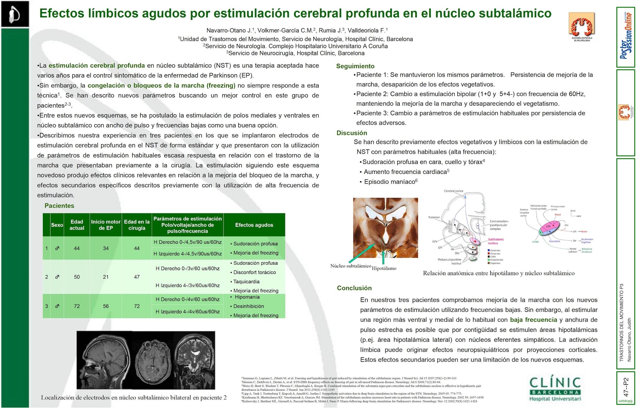 Efectos límbicos agudos por estimulación cerebral profunda en núcleo subtalámico
