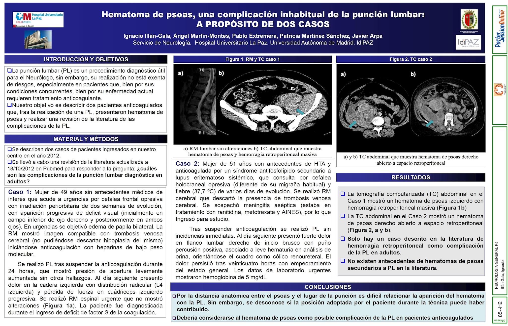 Hematoma de psoas, una complicación inhabitual de la punción lumbar: a propósito de 2 casos