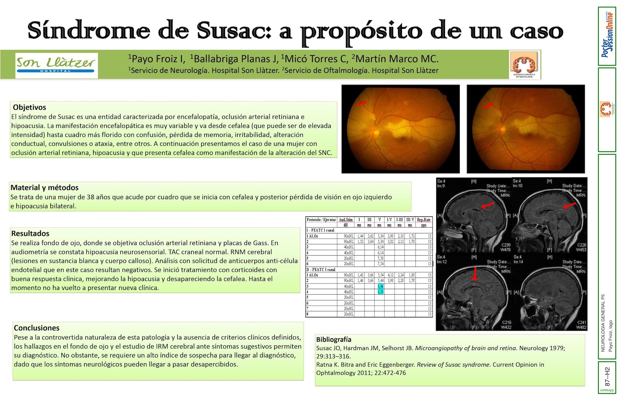 Síndrome de Susac: a propósito de un caso