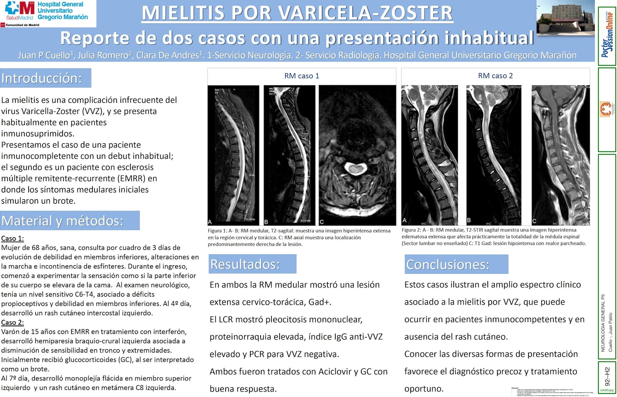 Mielitis por Varicela-Zoster: reporte de dos casos con una presentación inhabitual