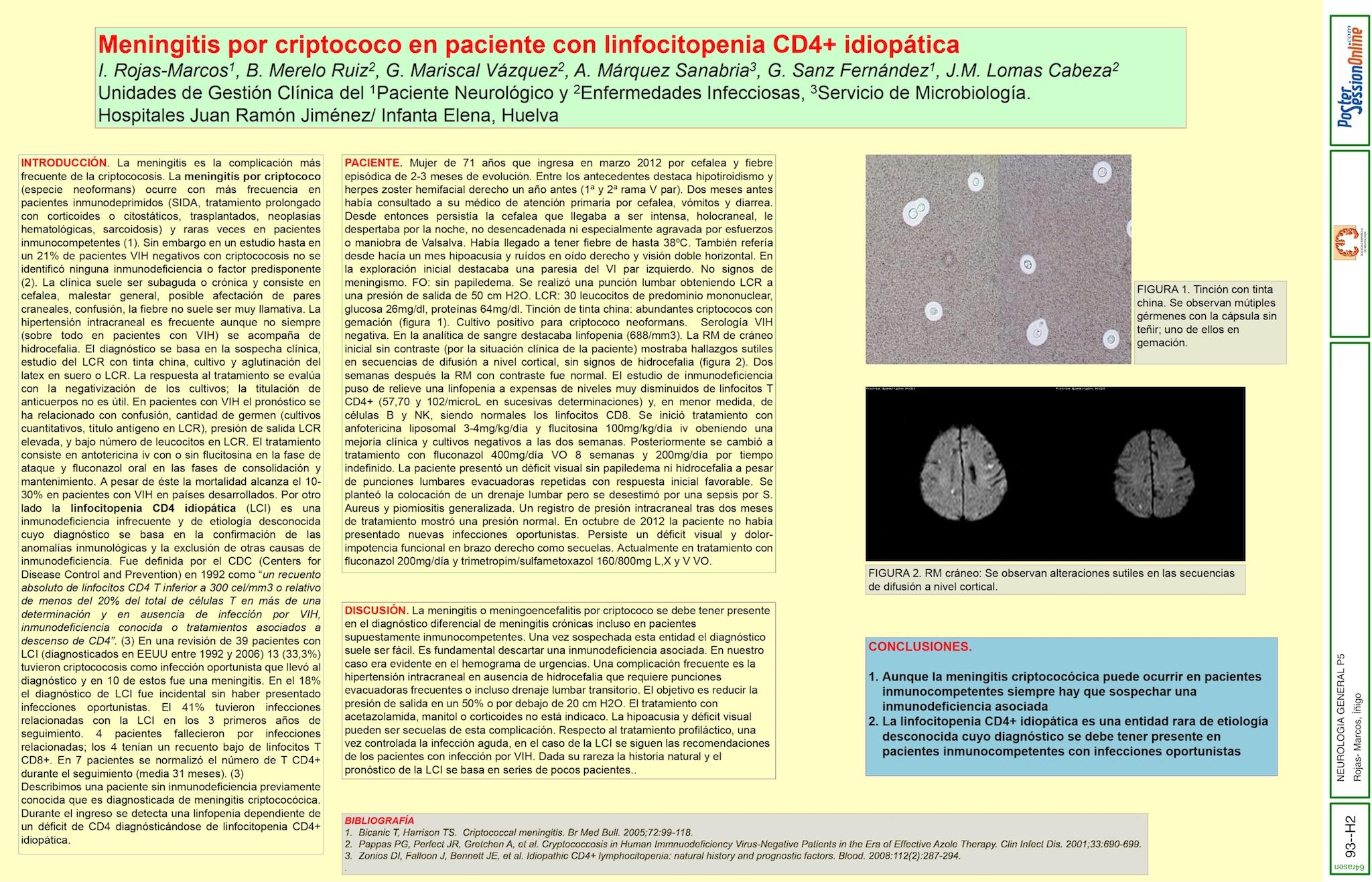 Meningitis por criptococo en paciente con linfocitopenia CD4 idiopática