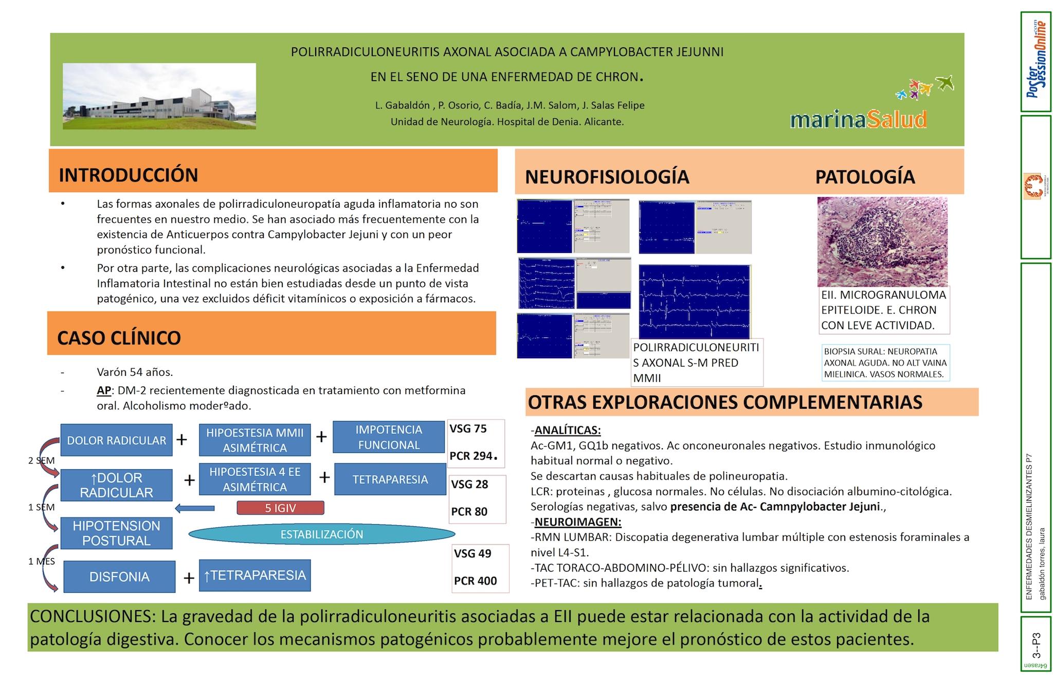 POLIRRADICULONEURITIS AXONAL ASOCIADA A CAMPYLOBACTER JEJUNNI EN EL SENO DE UNA ENFERMEDAD DE CHRON.