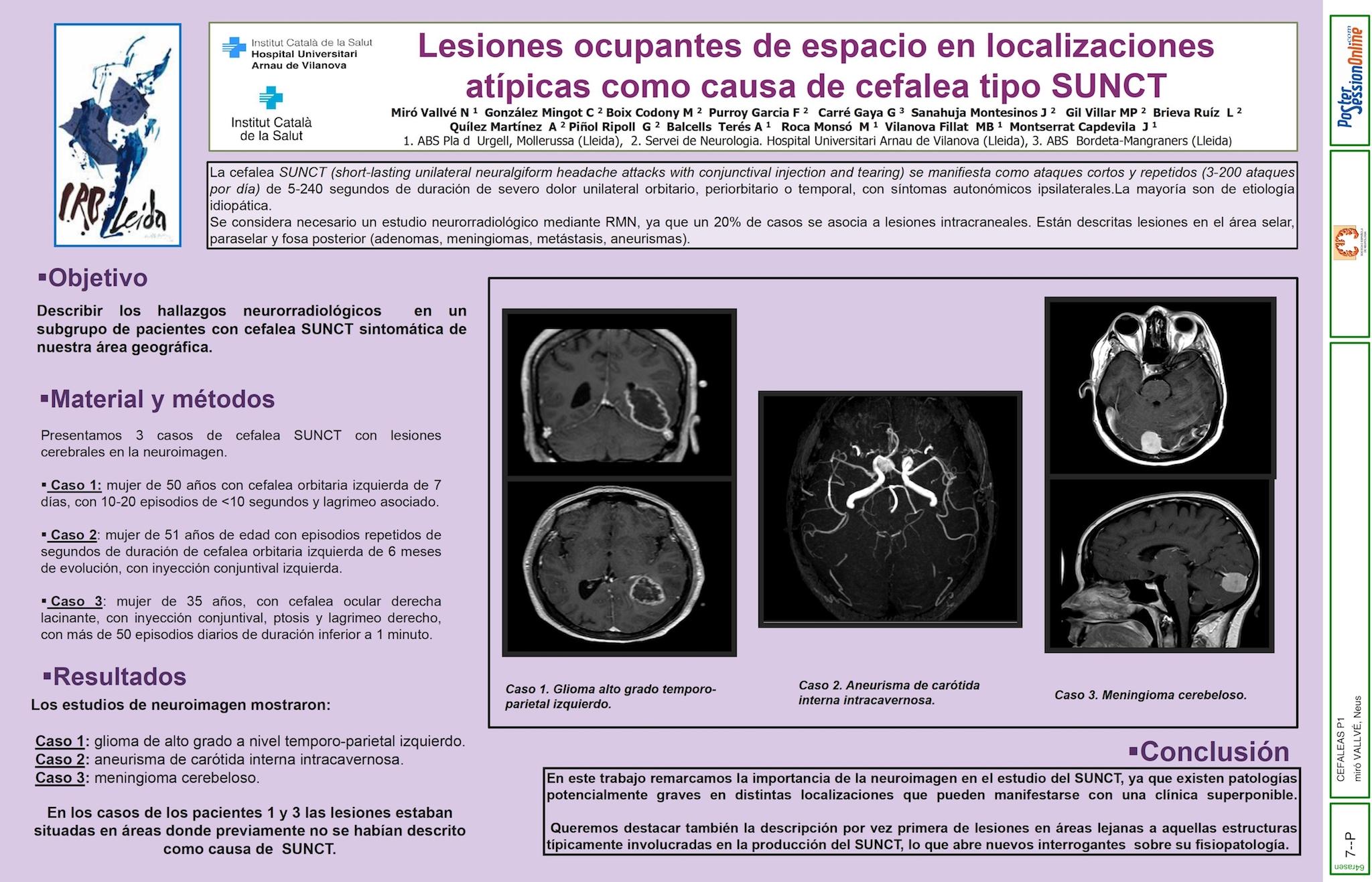 Lesiones ocupantes de espacio en localizaciones atípicas como causa de cefalea tipo SUNCT