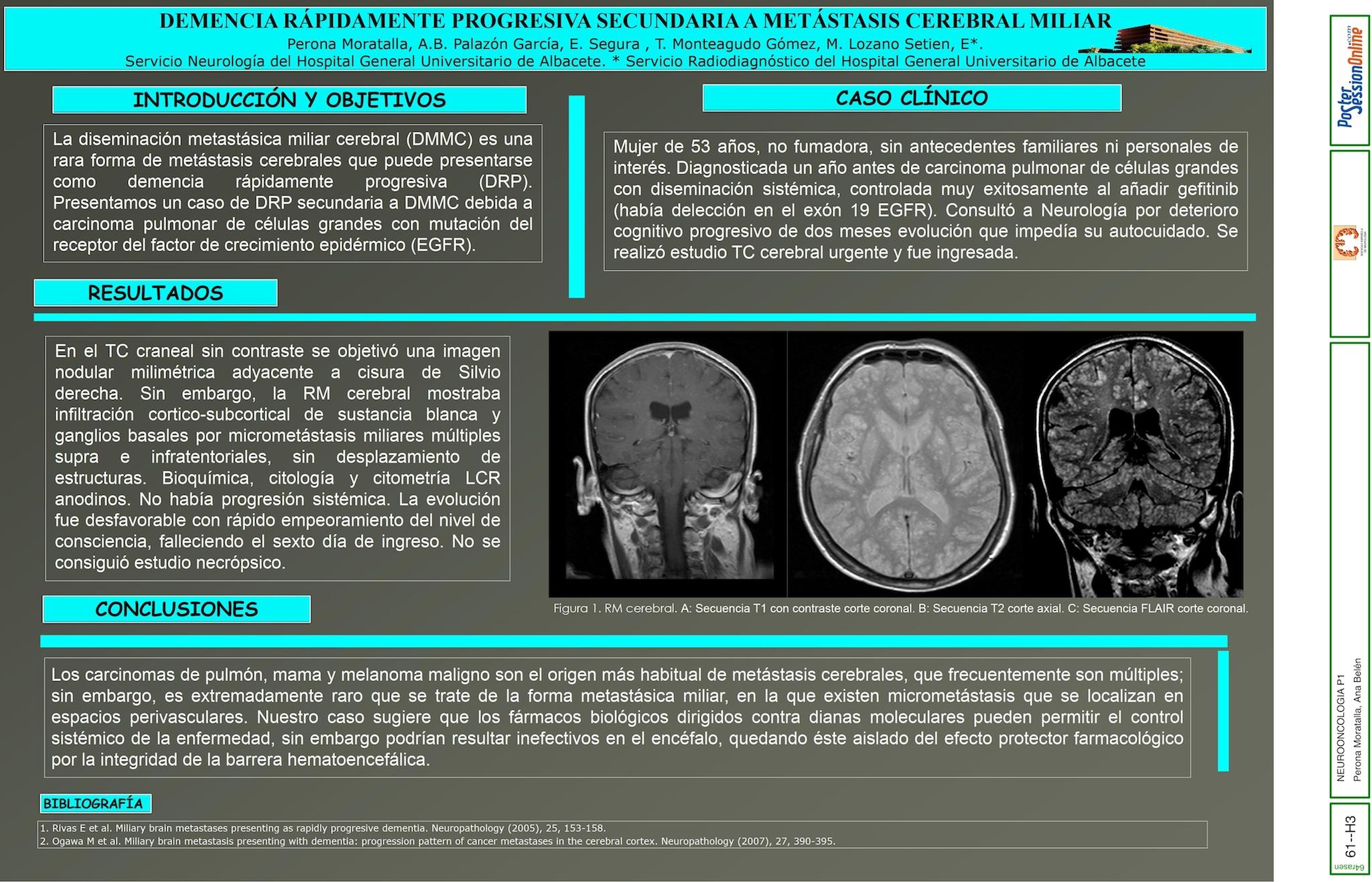 DEMENCIA RÁPIDAMENTE PROGRESIVA SECUNDARIA A METÁSTASIS CEREBRAL MILIAR
