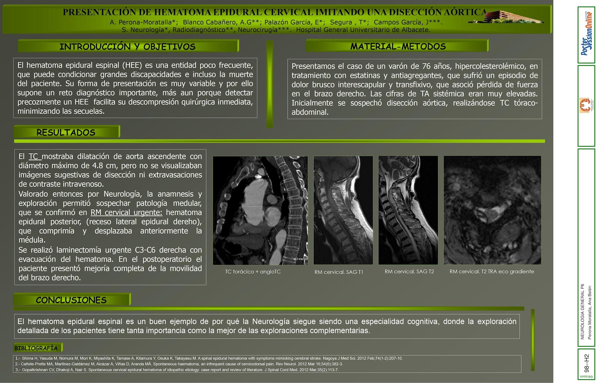 PRESENTACIÓN DE HEMATOMA EPIDURAL CERVICAL IMITANDO UNA DISECCIÓN AÓRTICA.
