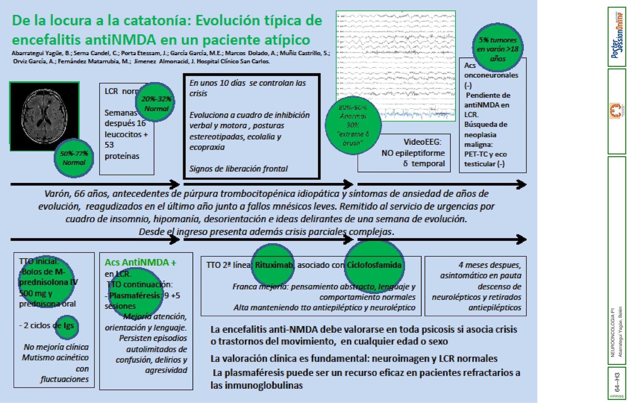 De la locura a la catatonía: Evolución típica de encefalitis antiNMDA en un paciente atípico
