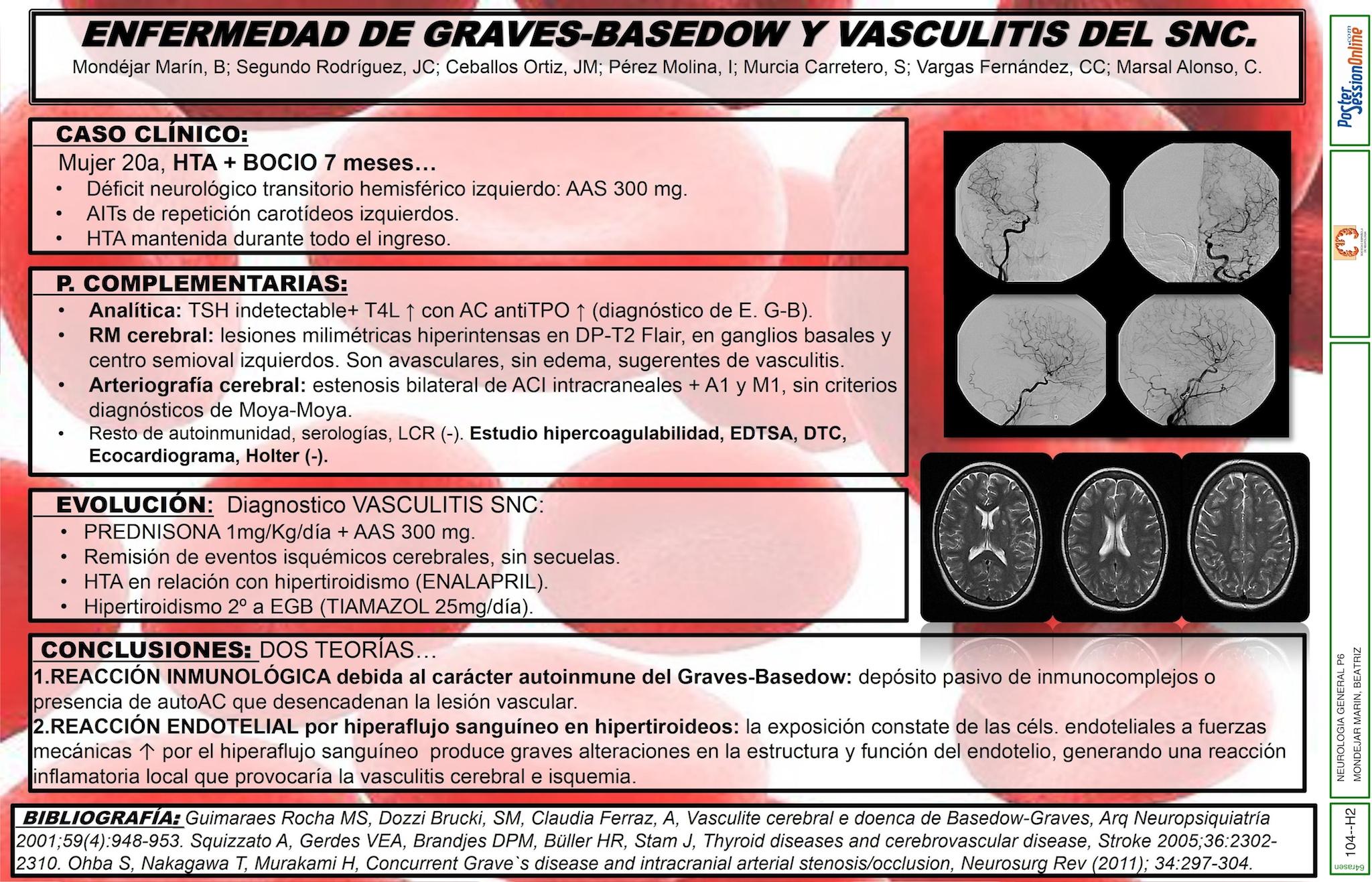 ENFERMEDAD DE GRAVES-BASEDOW Y VASCULITIS DEL SNC. A PROPÓSITO DE UN CASO.