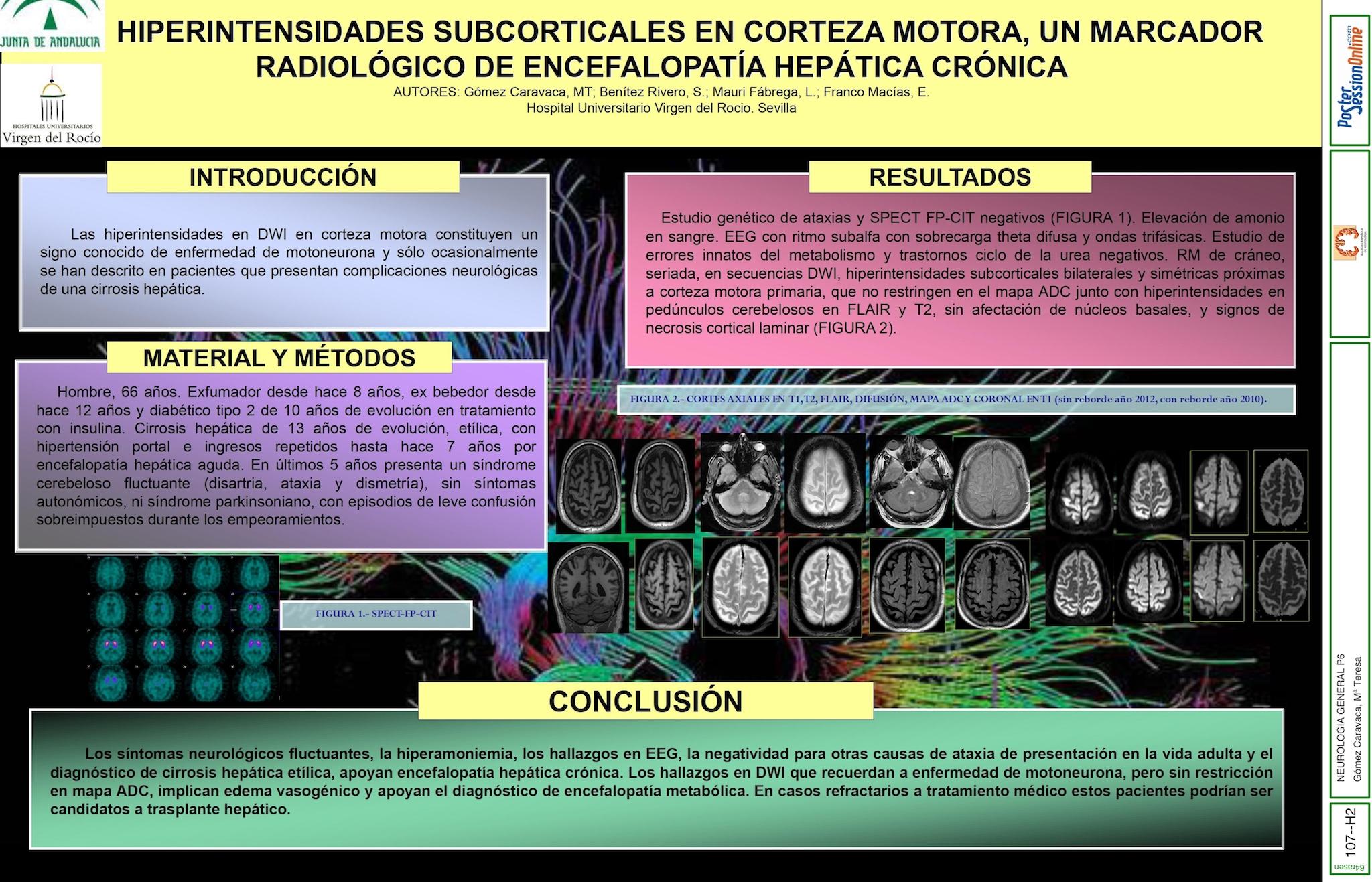 HIPERINTENSIDADES SUBCORTICALES EN CORTEZA MOTORA, UN MARCADOR RADIOLÓGICO DE ENCEFALOPATÍA HEPÁTICA CRÓNICA