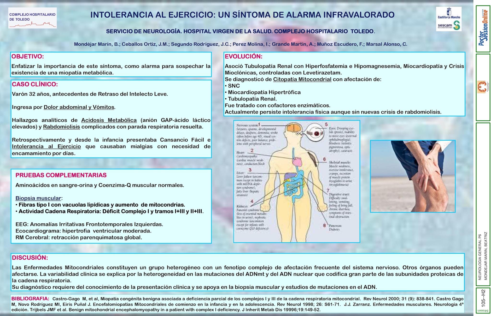 INTOLERANCIA AL EJERCICIO: UN SÍNTOMA DE ALARMA INFRAVALORADO
